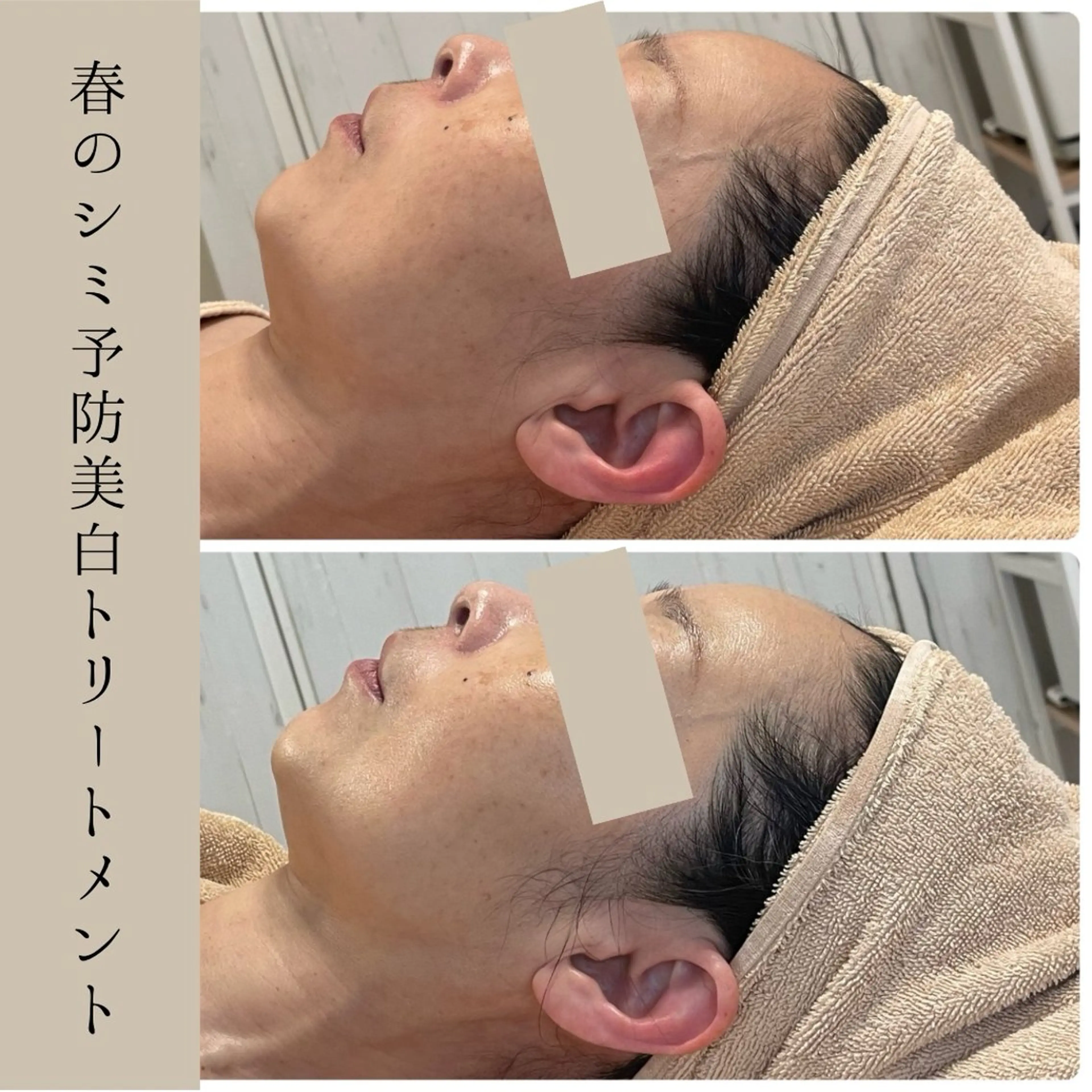 小顔・たるみケア✨ フェイシャル&ボディのエステ・リラクイメージ