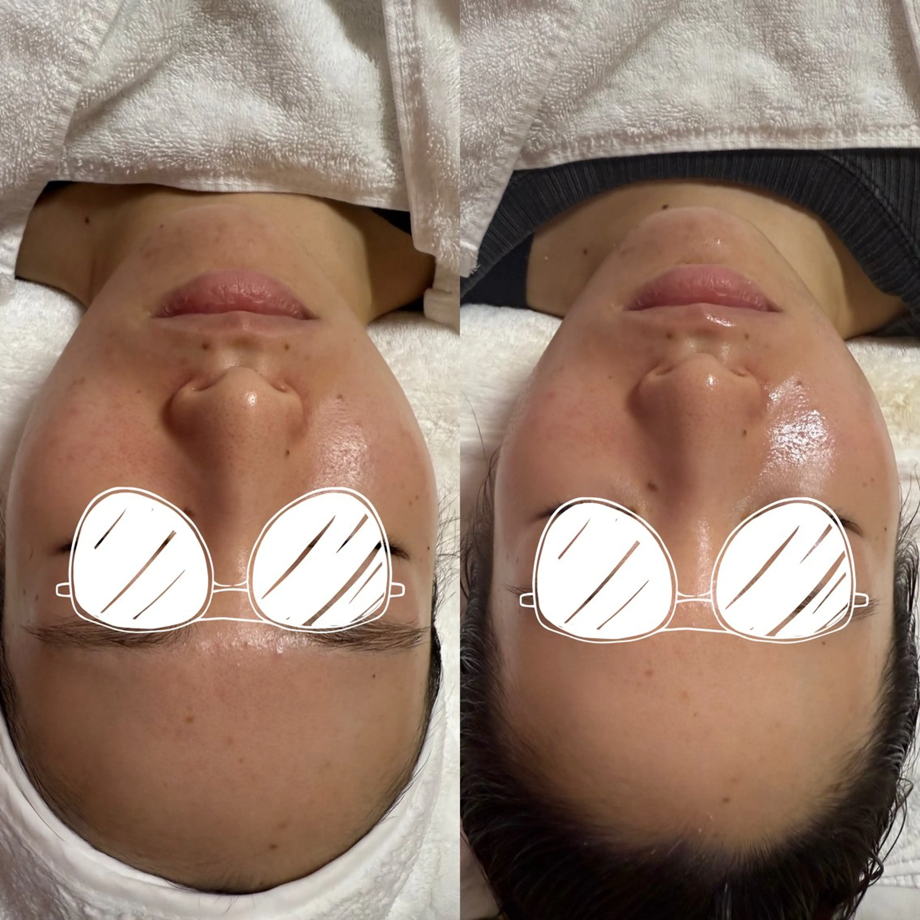 エステ Bloom所属・ネイル＆フェイシャル Bloomのエステ・リラクイメージ