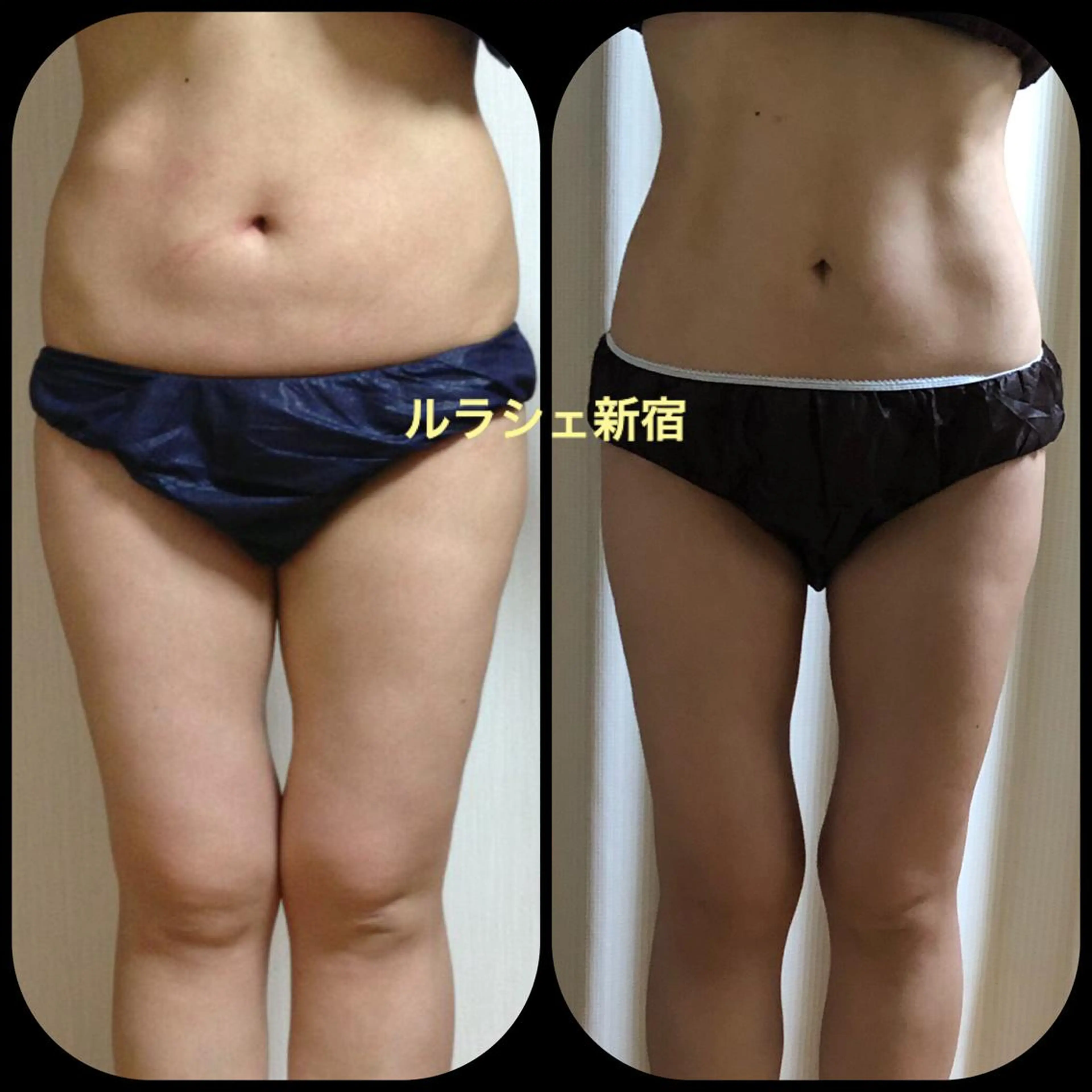 人気NO１【足つぼ付き】オールハンド全身⭐️筋膜リリースインド式痩身🔥大量発汗🔥施術時間90分⭐︎の写真