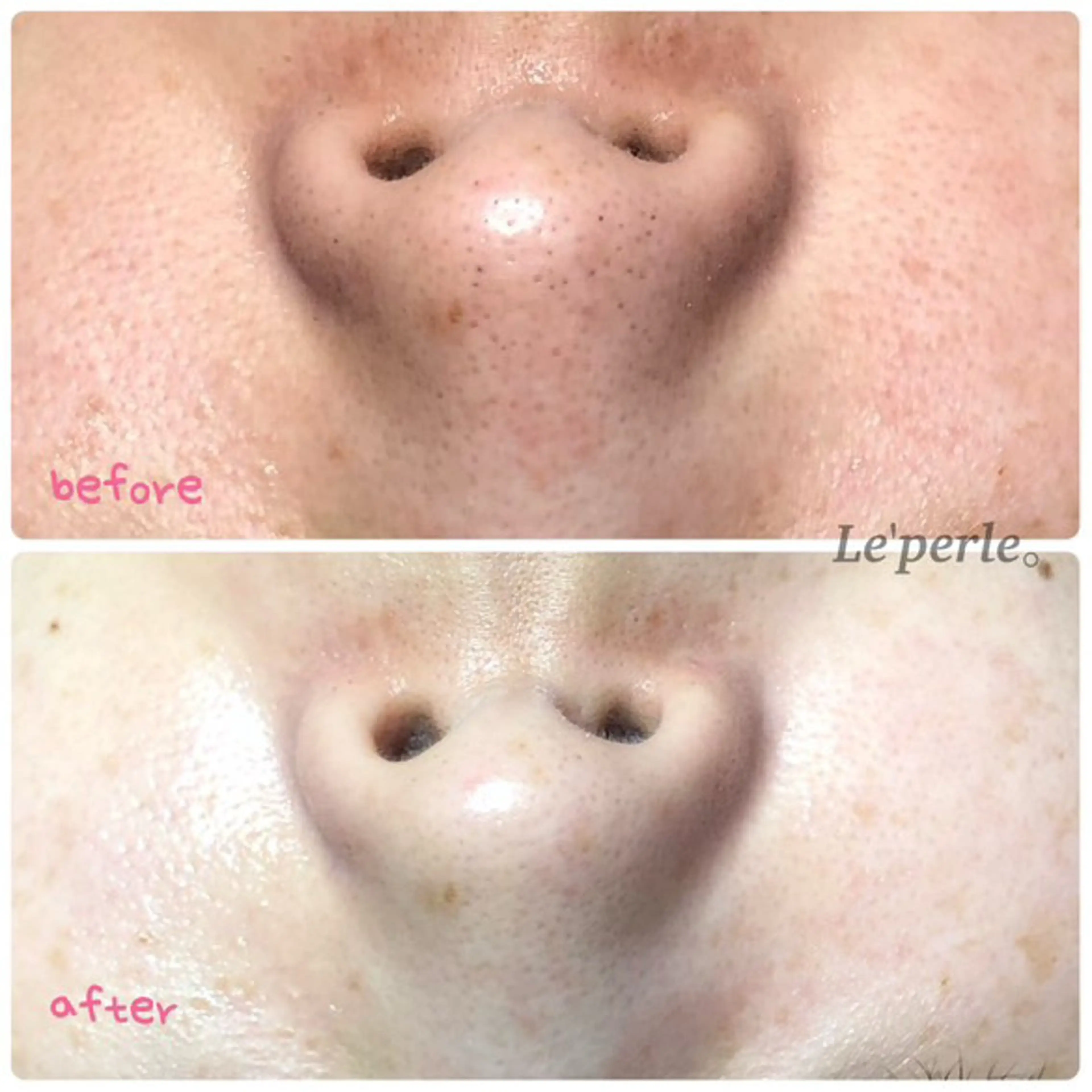 Le'perle。所属・Le'perle。 Kyokaのエステ・リラクイメージ