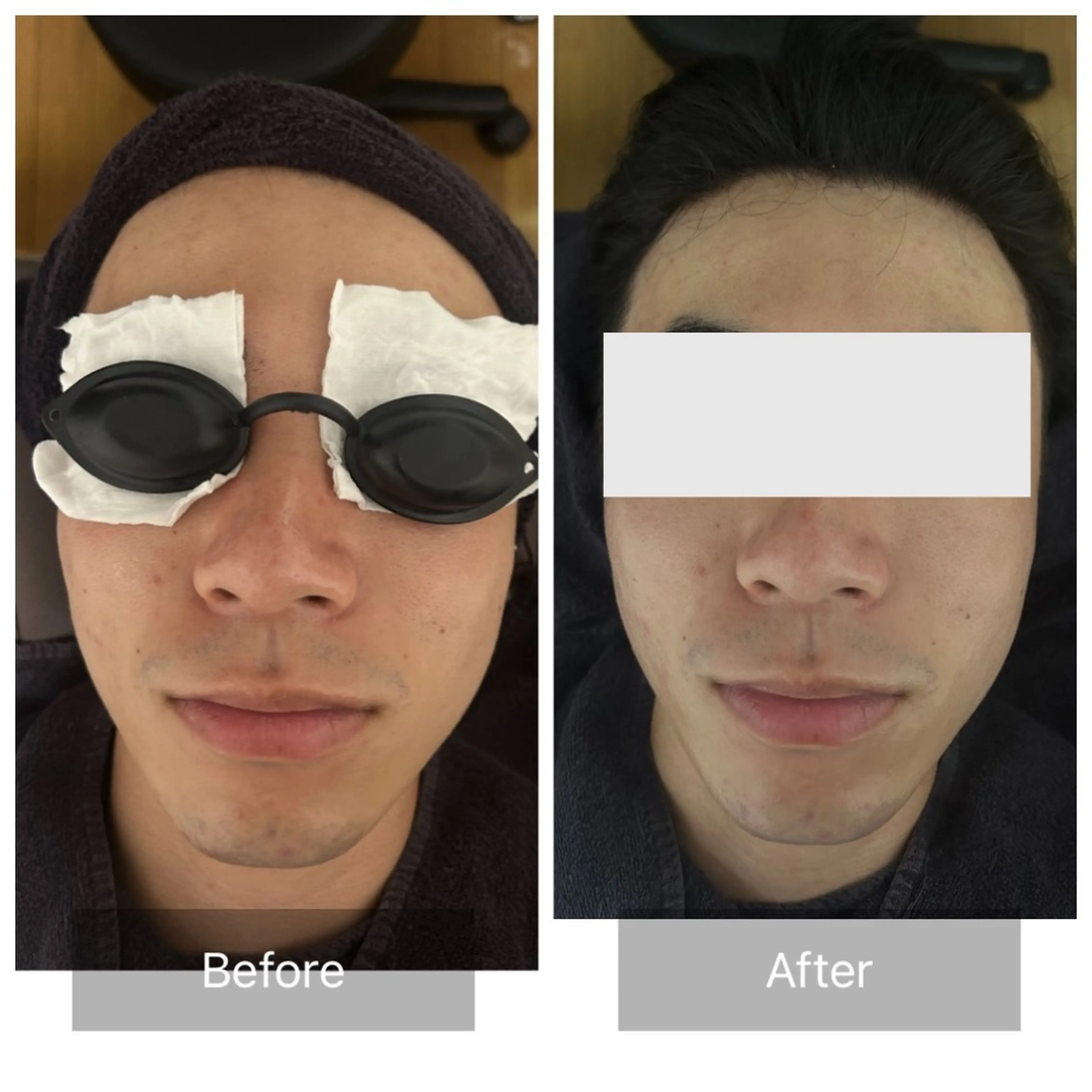 メンズ エマニエル USAのエステ・リラクイメージ