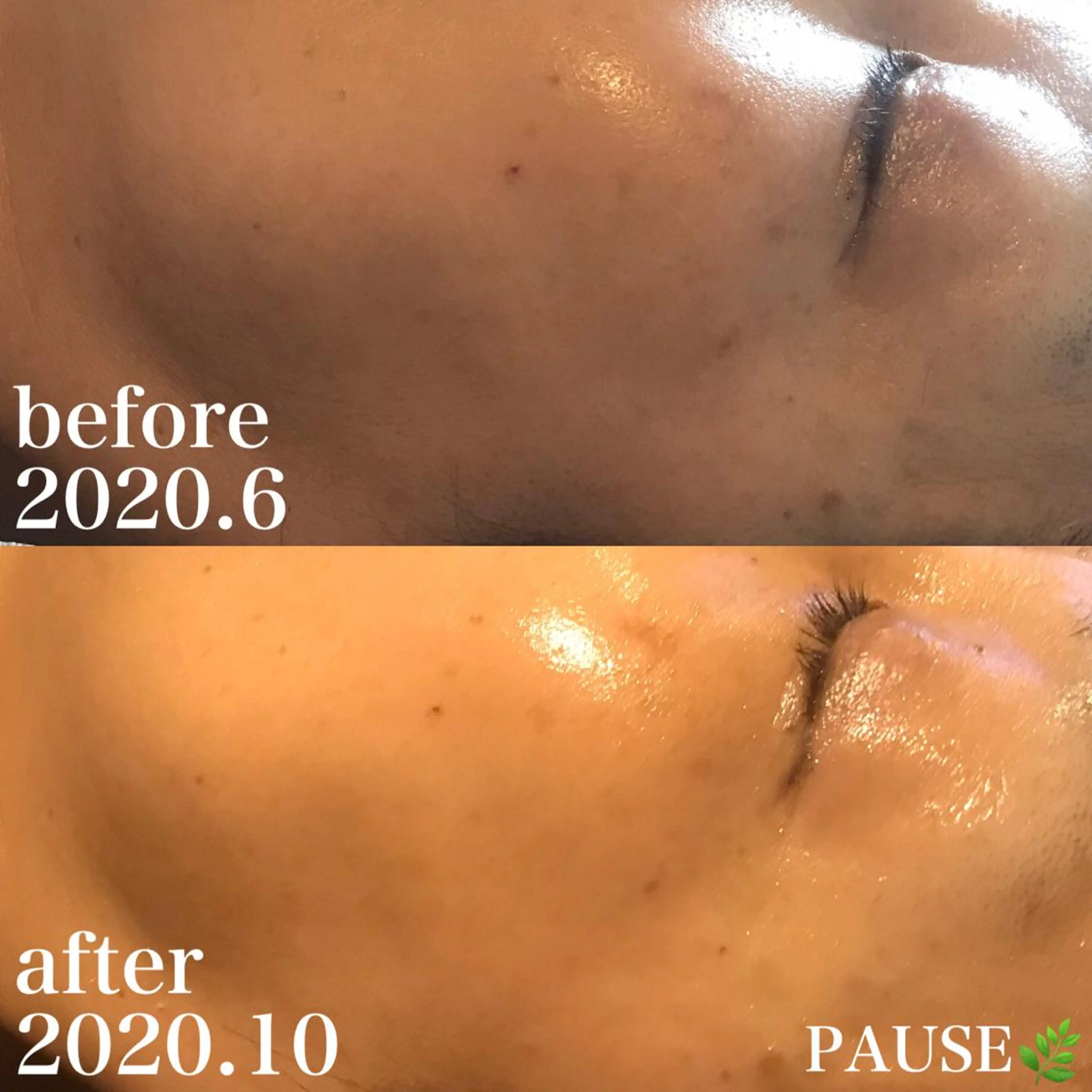 エステ 浜野 恵美のエステ・リラクイメージ