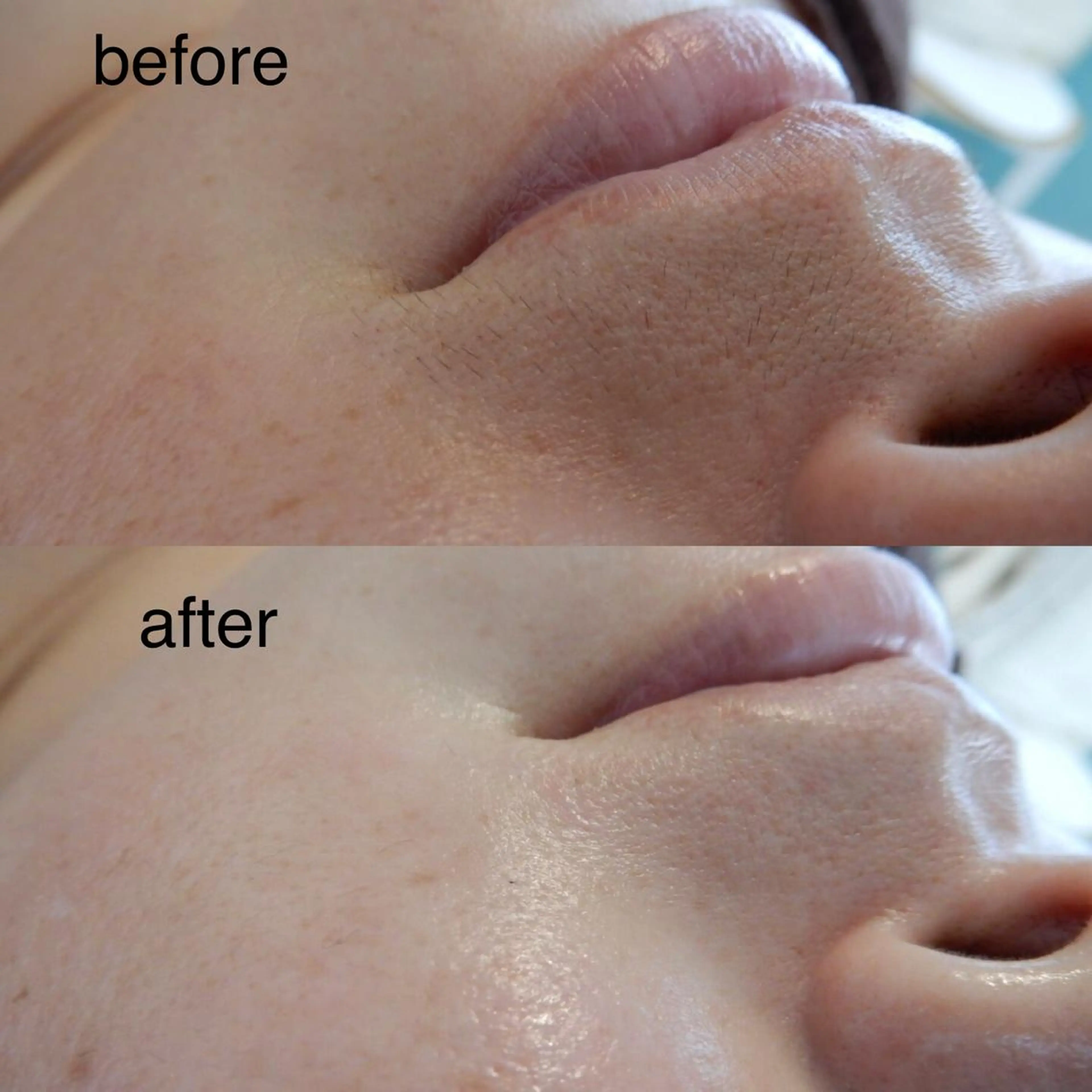 酵素エステ&糸脱毛 baby skinのエステ・リラクイメージ