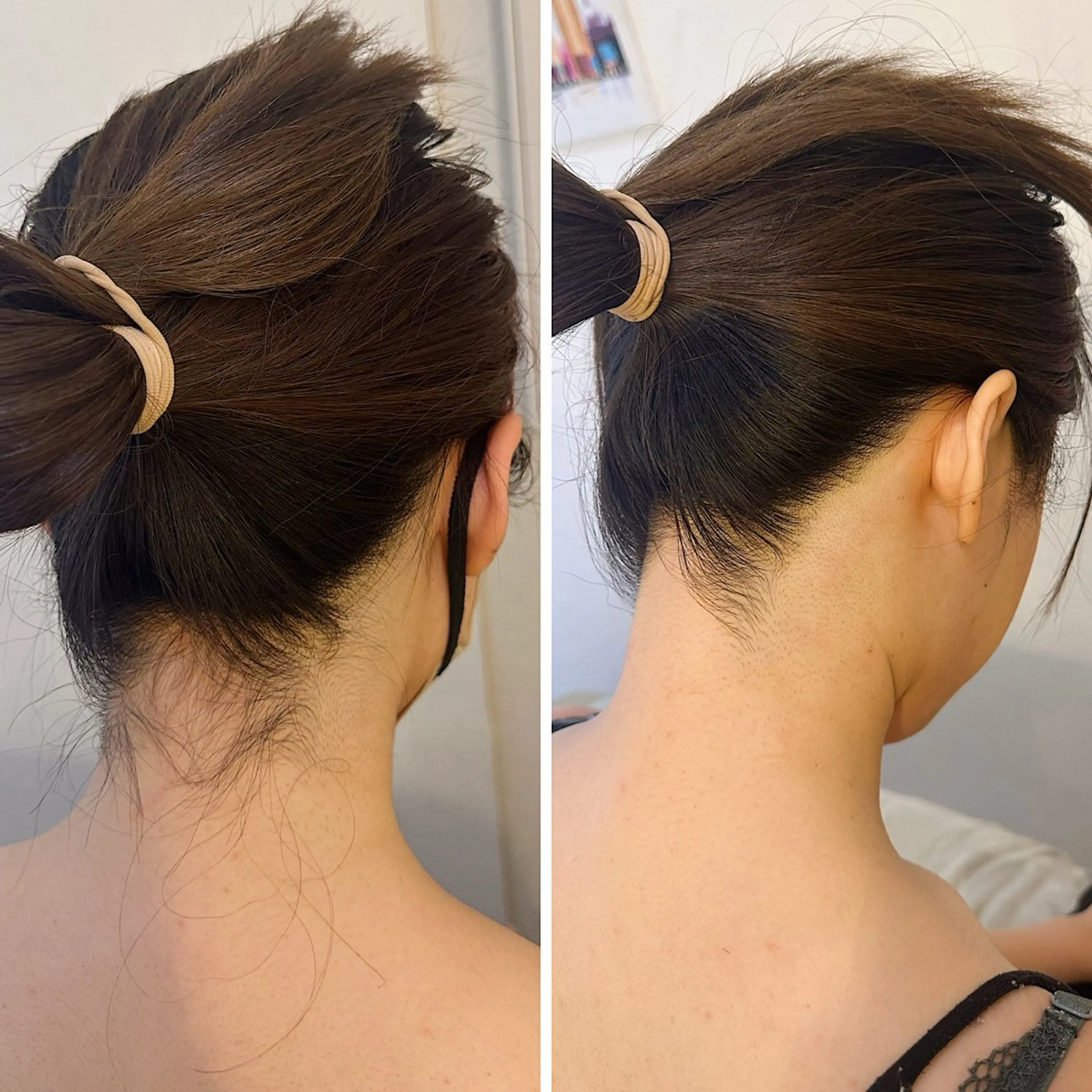 脱毛 うなじ脱毛/美肌脱毛 LABELのエステ・リラクイメージ