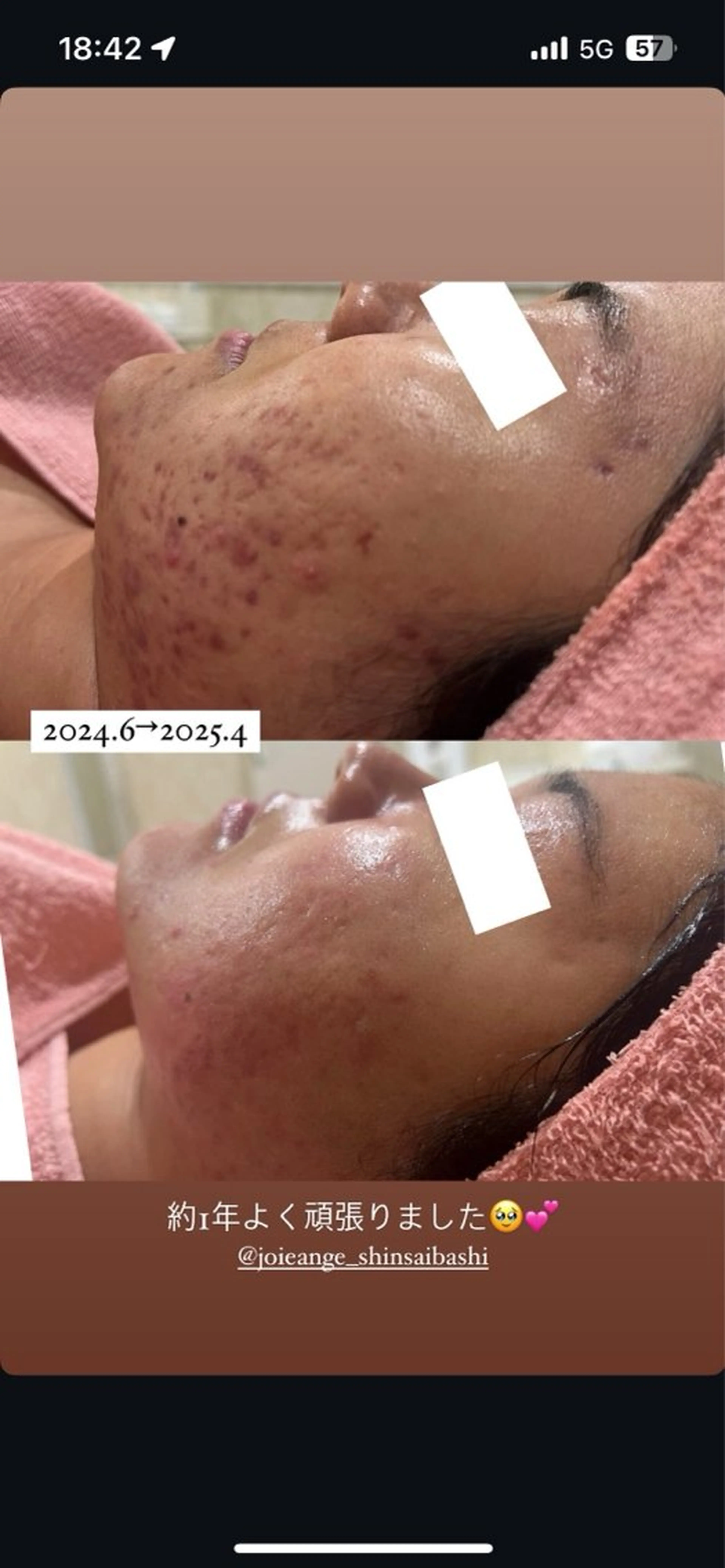 エステ フェイシャル/脱毛 ジョアアンジェ竹田のエステ・リラクイメージ