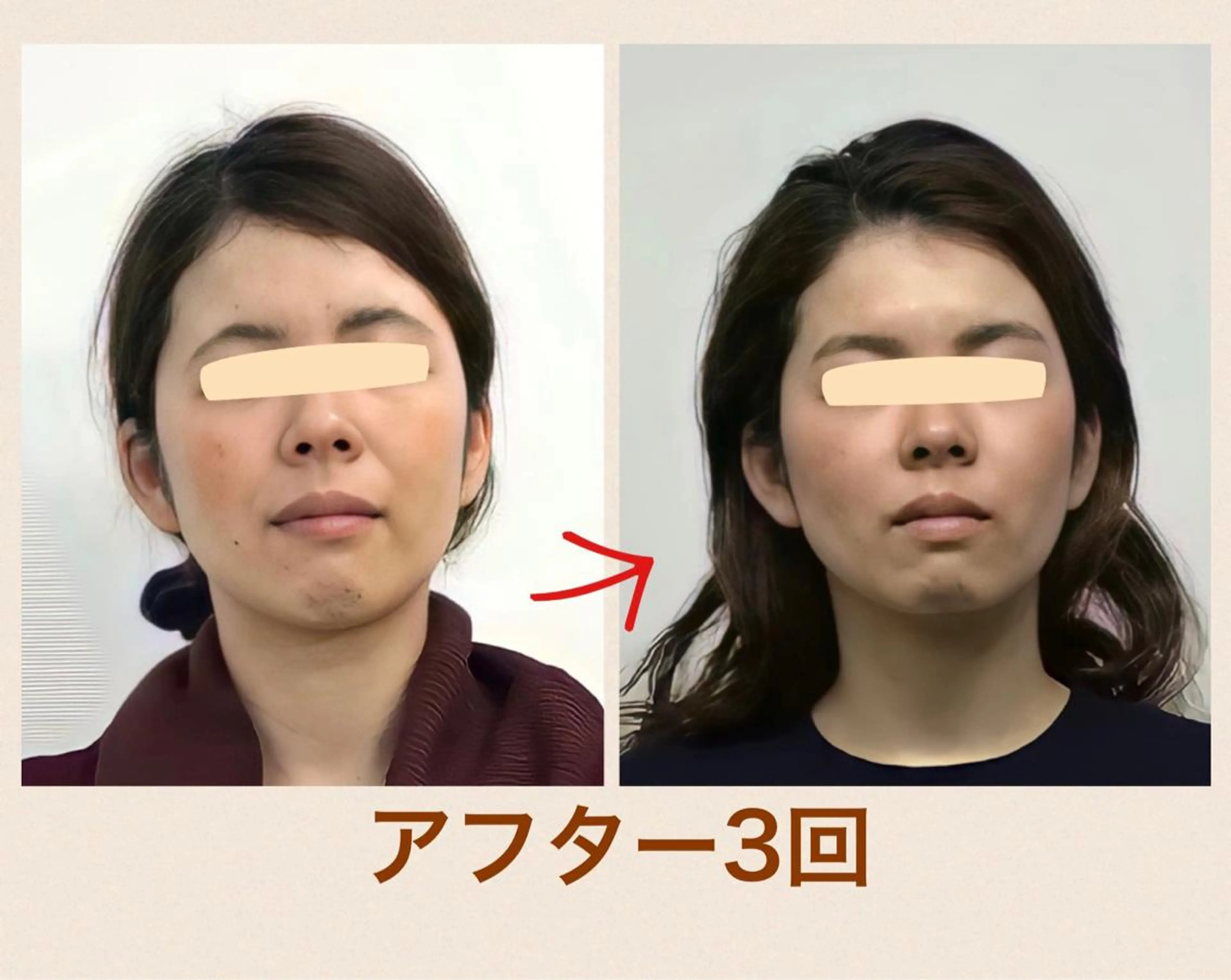 あまこ りゅういちのエステ・リラクイメージ