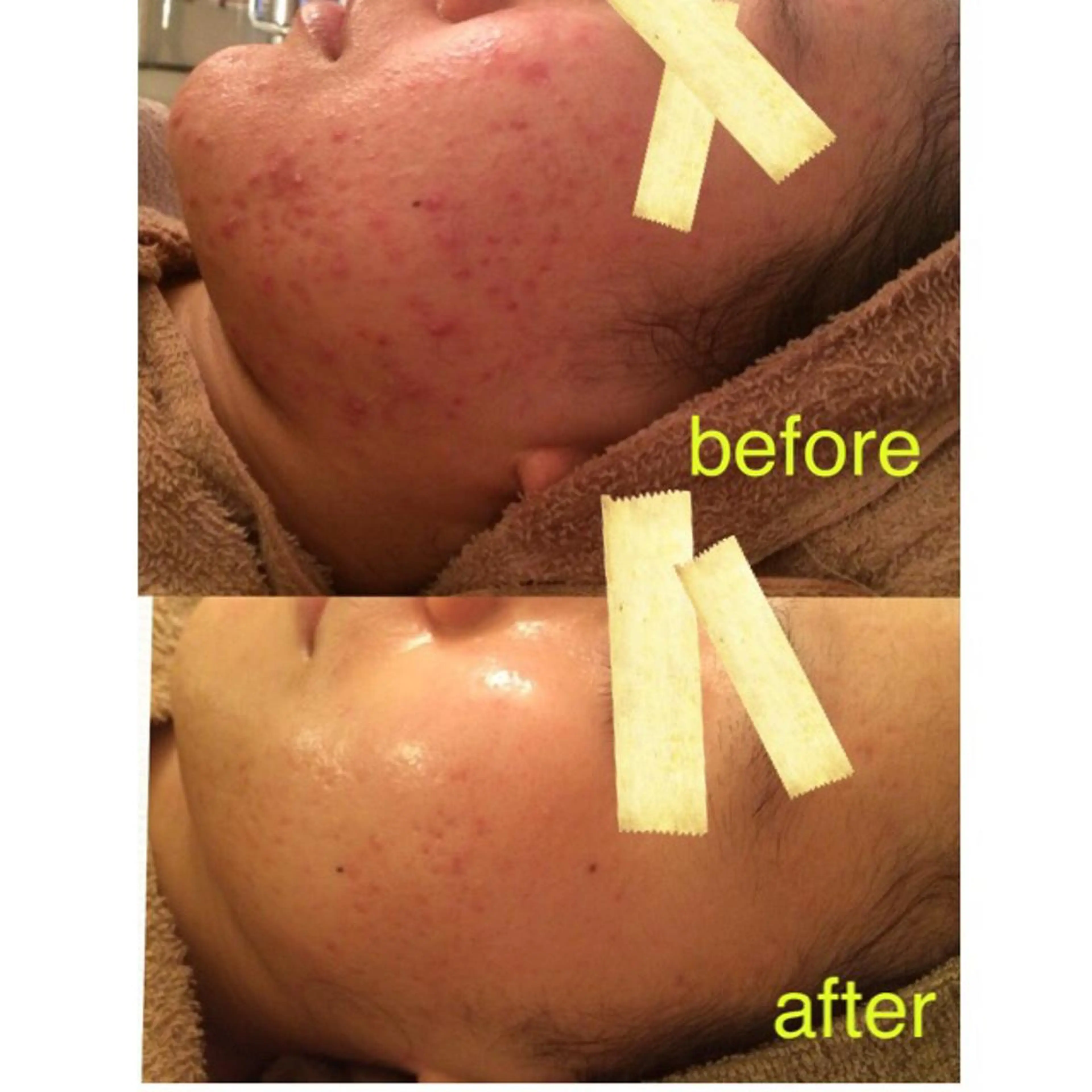 エステ フェイシャル専門 肌質改善/プランスのエステ・リラクイメージ