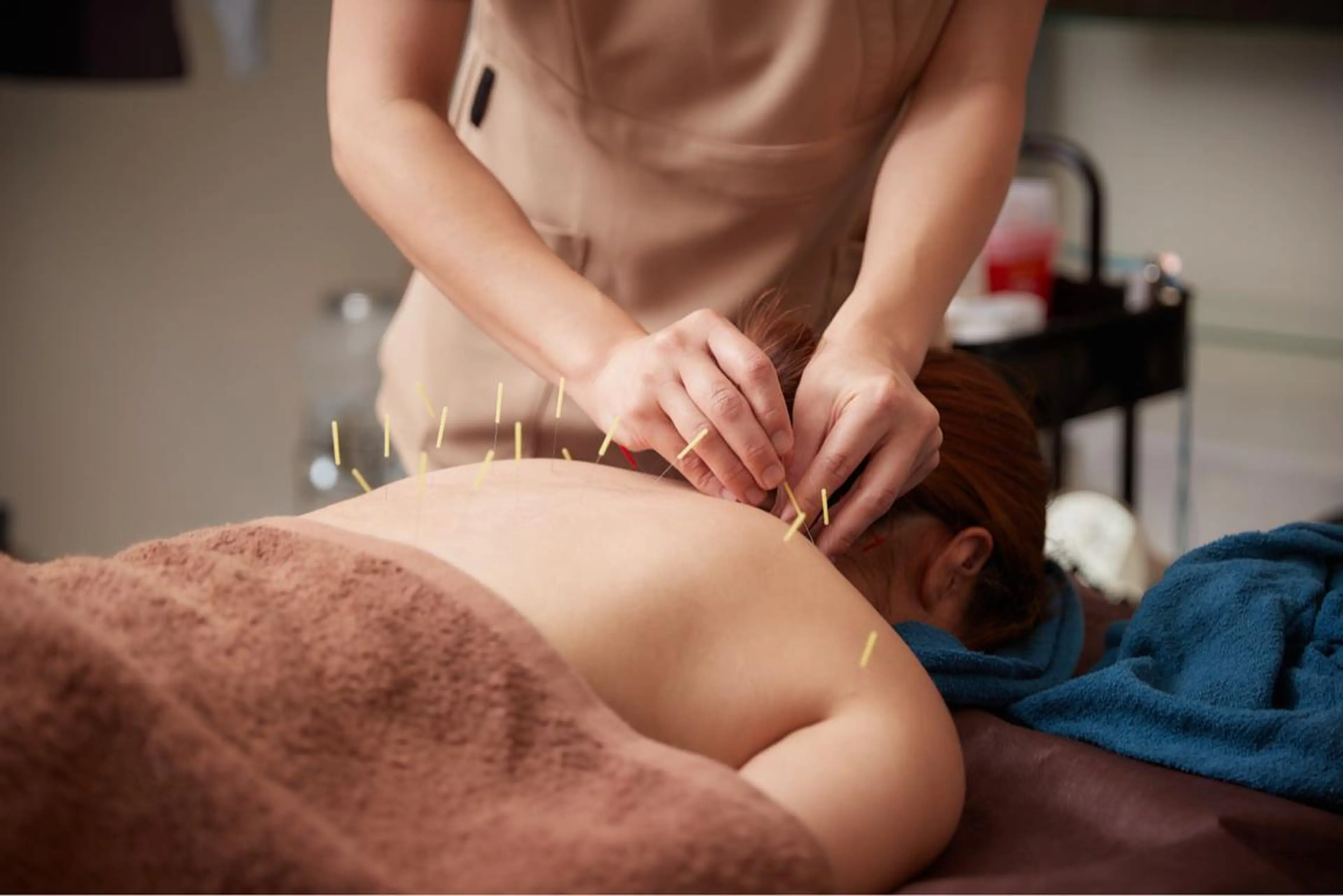 美楽鍼 びらくしんのその他イメージ