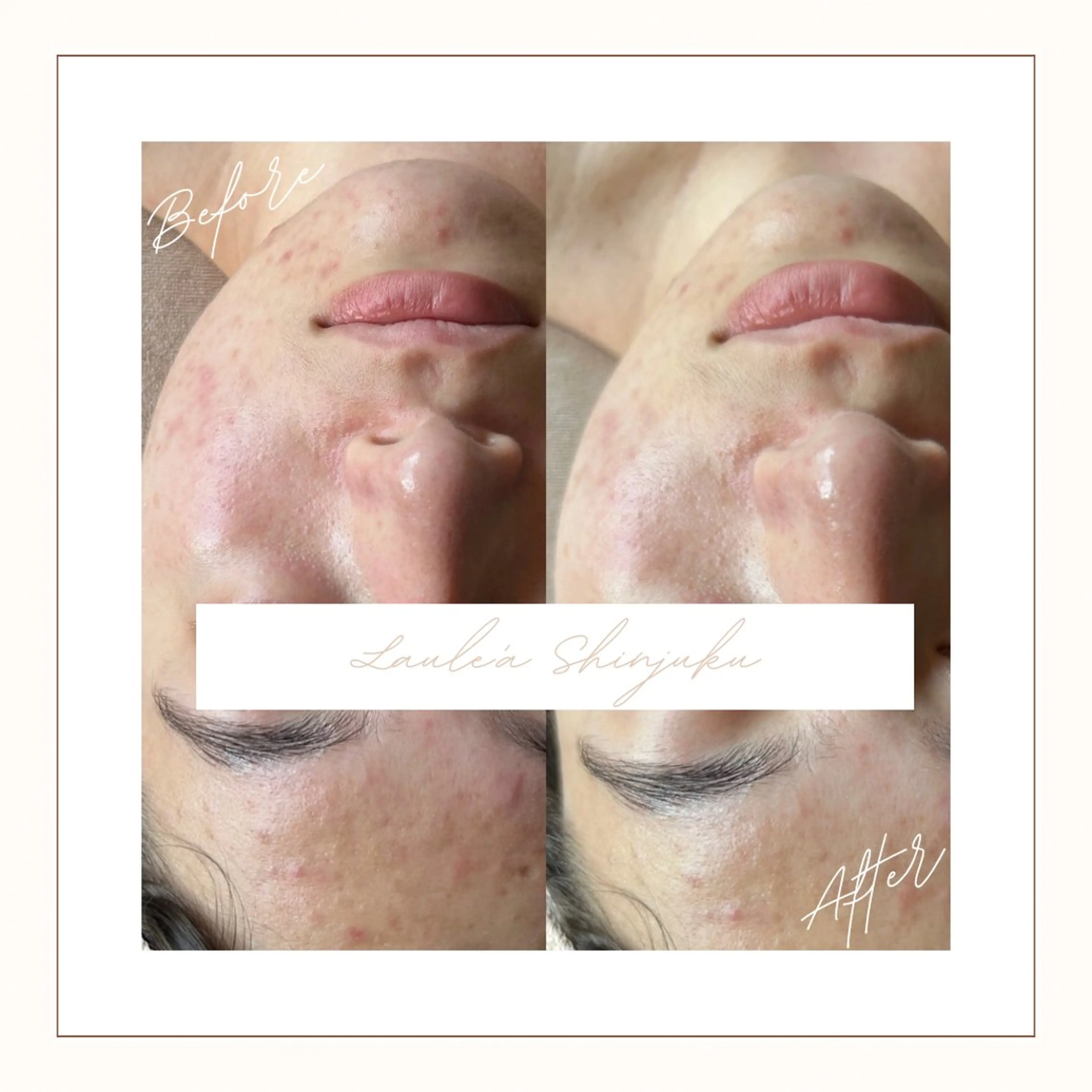 美腸サロン🌺 腸もみ/小顔/リンパのエステ・リラクイメージ