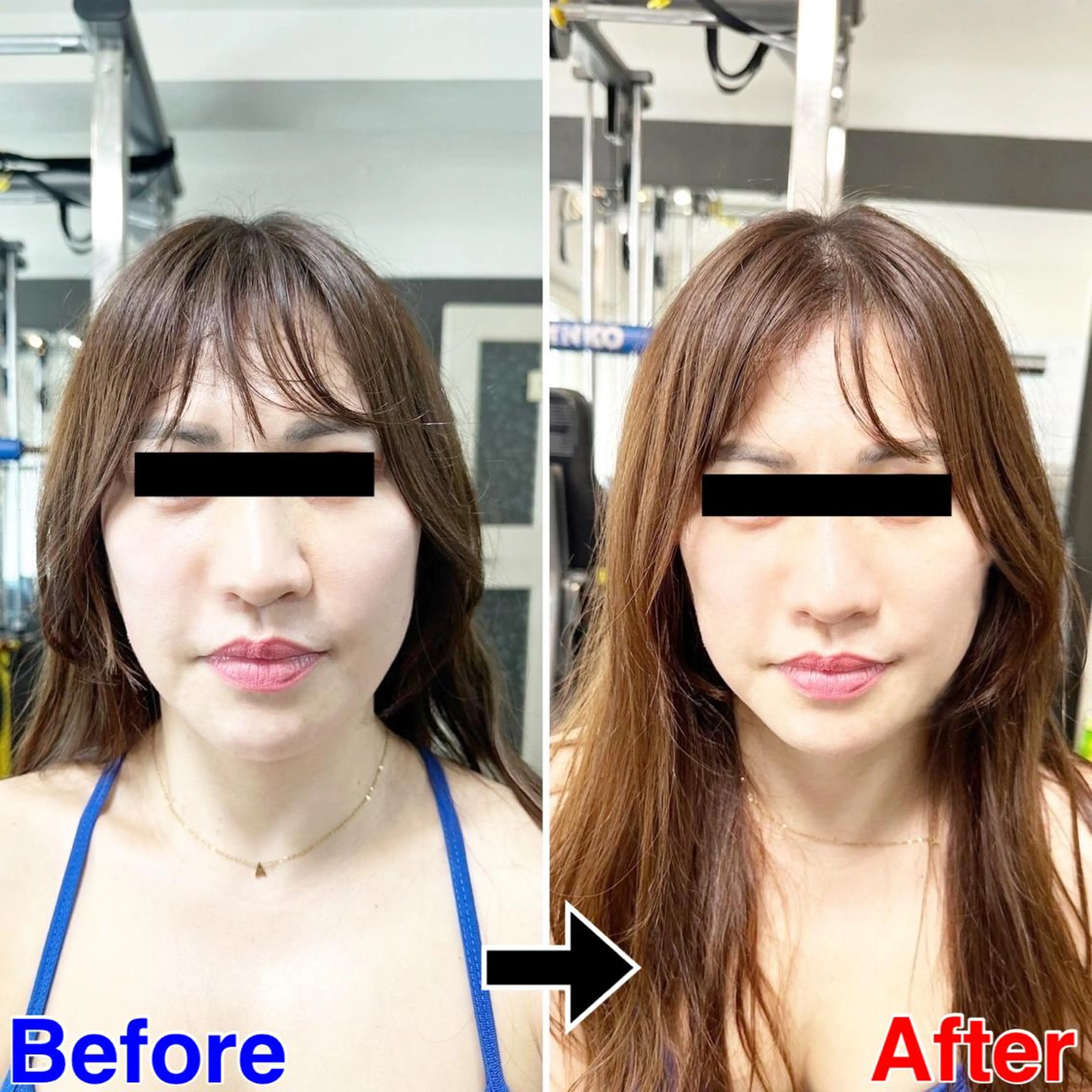 小顔矯正・美容鍼 FLOW鍼灸整体院のエステ・リラクイメージ