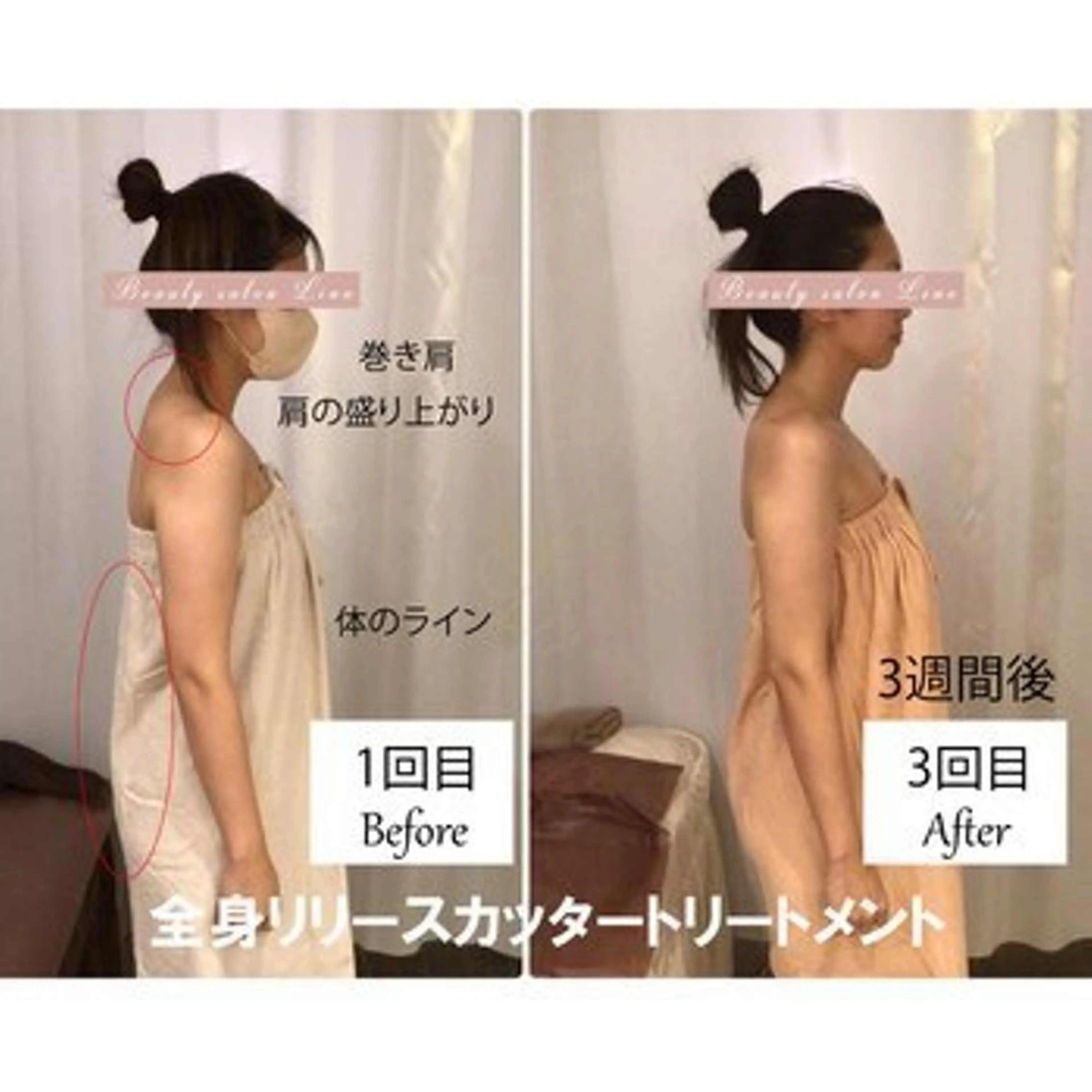 ブライダルサロン ｜Lino【堀江】のエステ・リラクイメージ