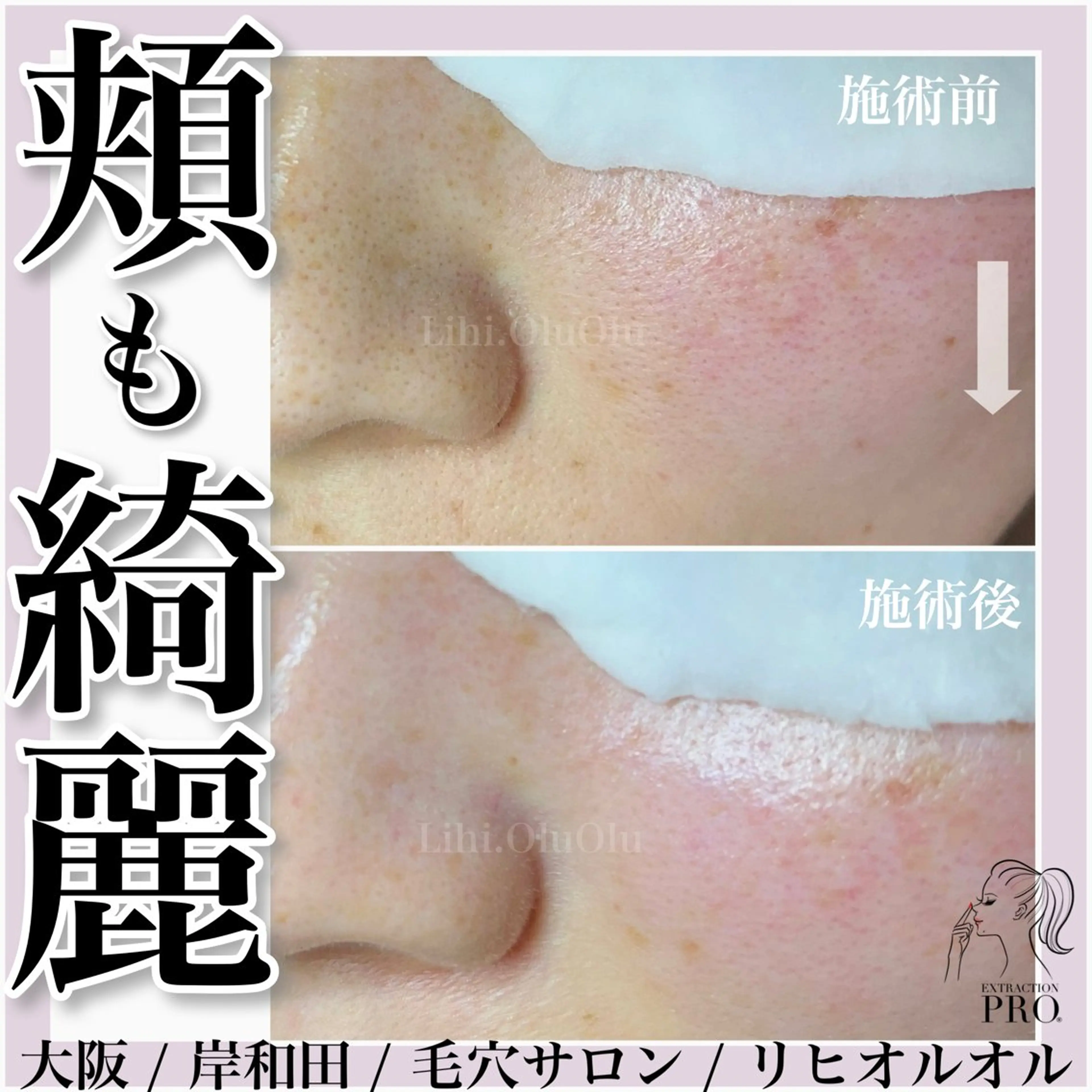 毛穴汚れ改善専門店/ 岸和田/リヒオルオルのエステ・リラクイメージ