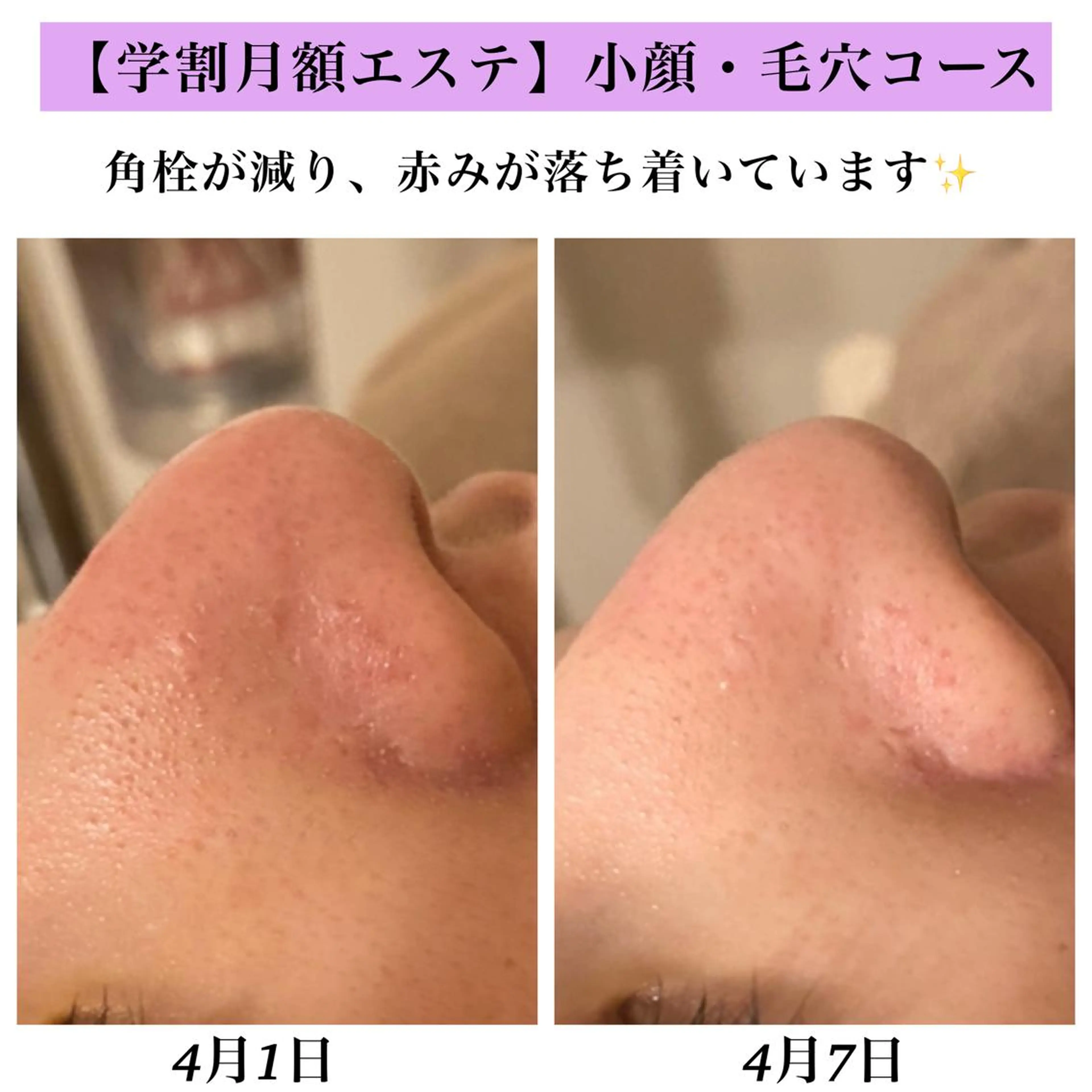 Bellesthe (ベルエステ)のエステ・リラクイメージ