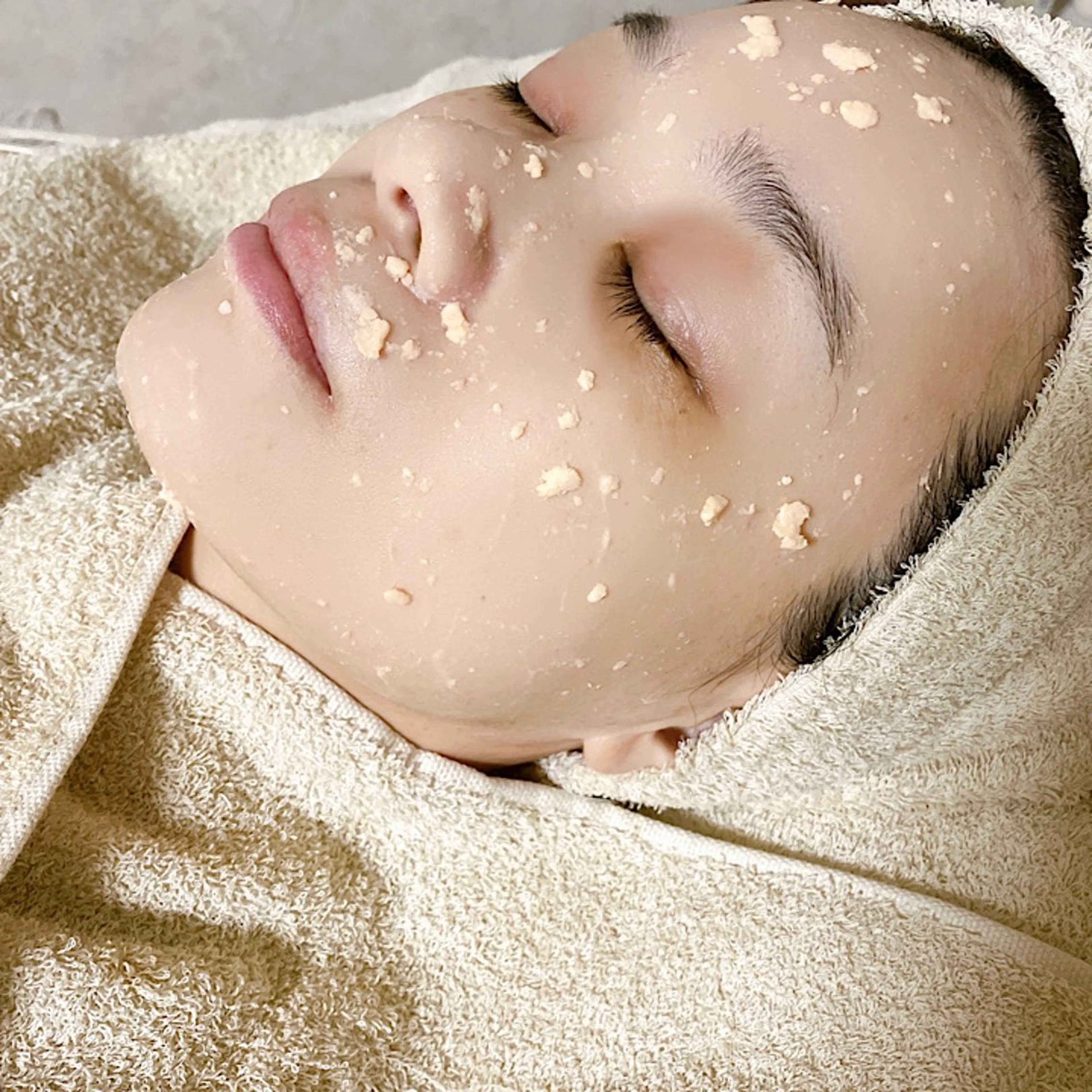 繰り返すニキビ・毛穴 ✨つくば肌質改善専門のエステ・リラクイメージ