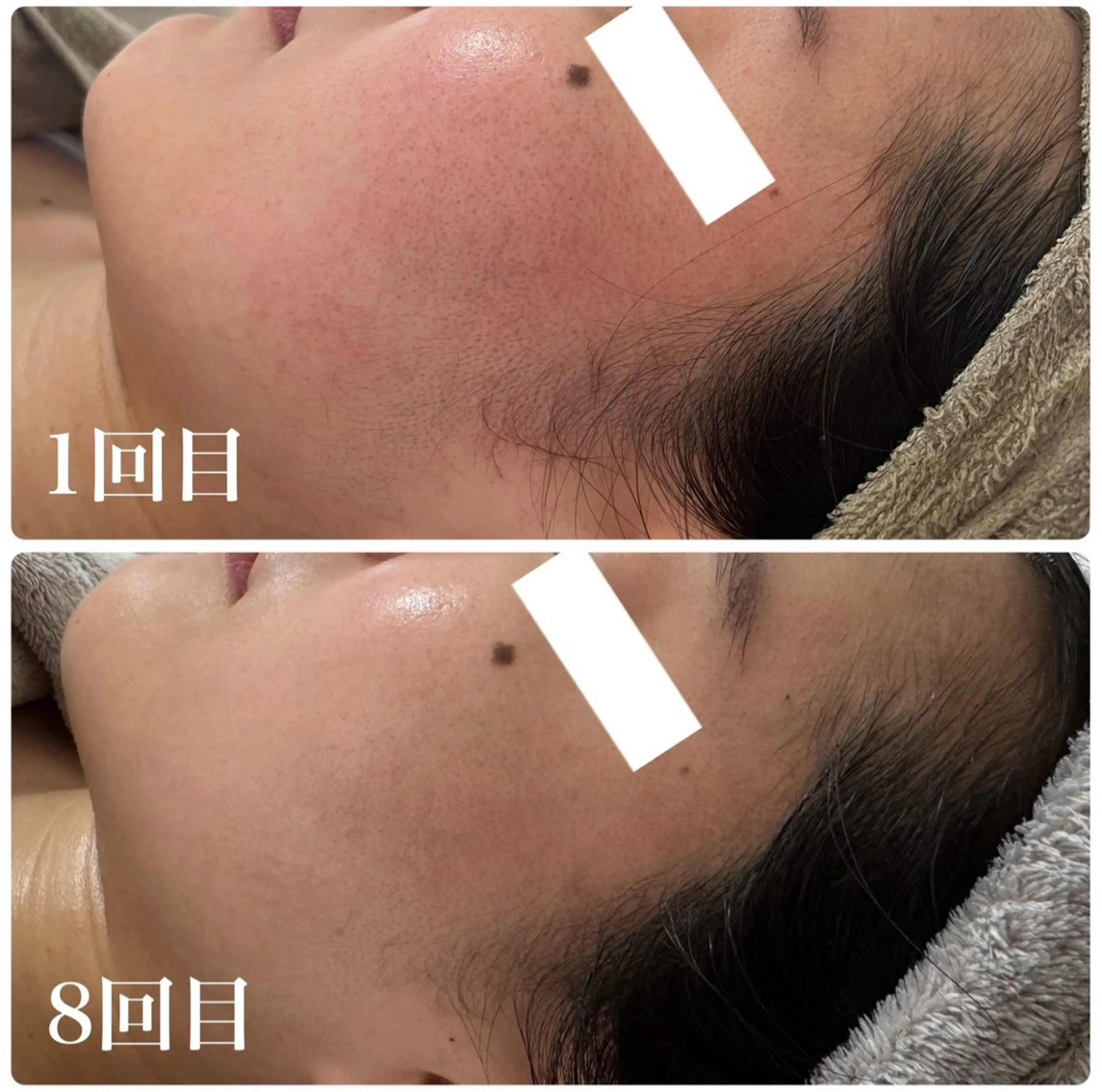 エステ Esthe salon Blanche(エステサロンブランシュ)所属・小顔リフトアップ 美肌改善専門店のエステ・リラクイメージ