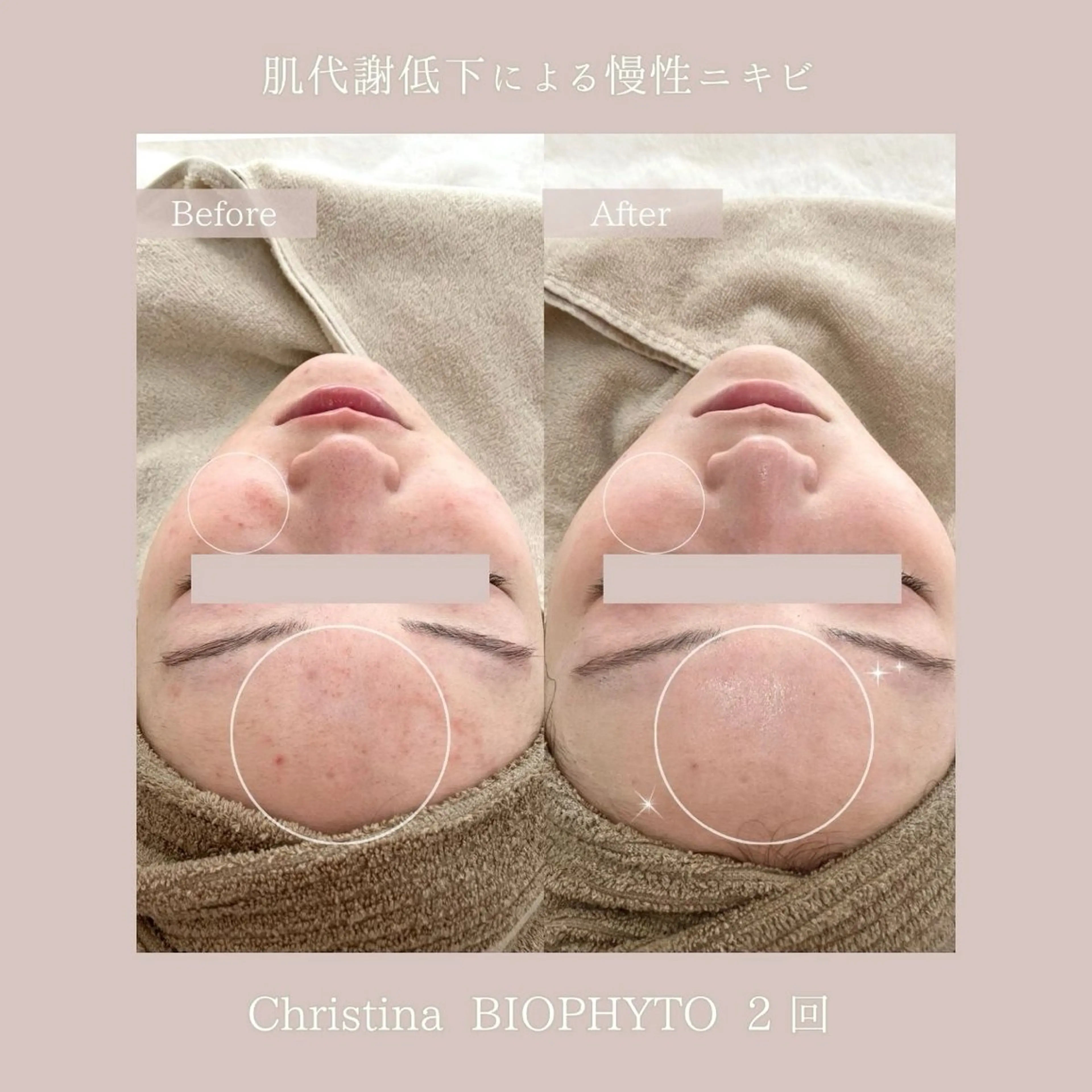 エステ Lyséa新宿 ♡kaoriのエステ・リラクイメージ