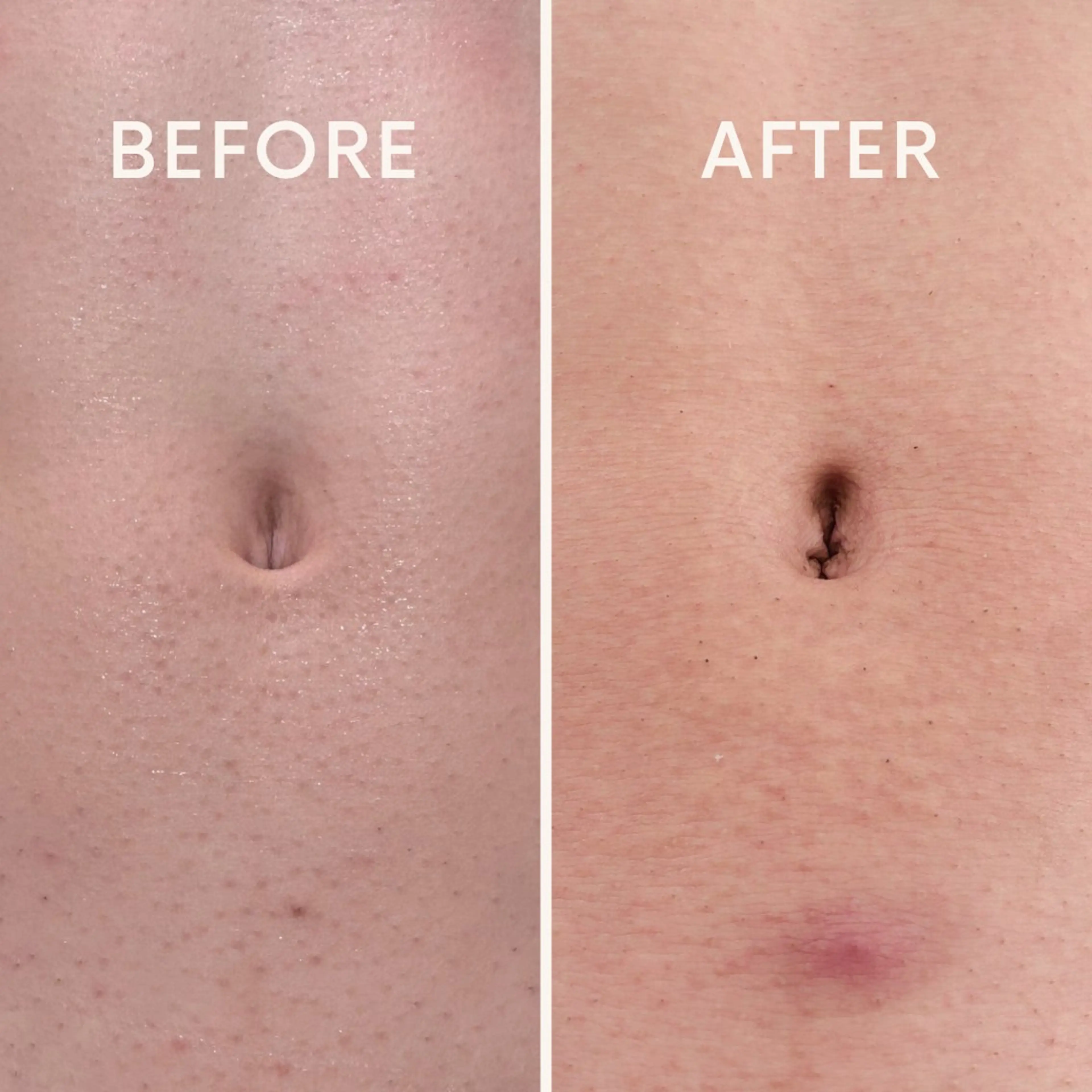 🎀RIA🎀 脱毛/フェイシャルのエステ・リラクイメージ