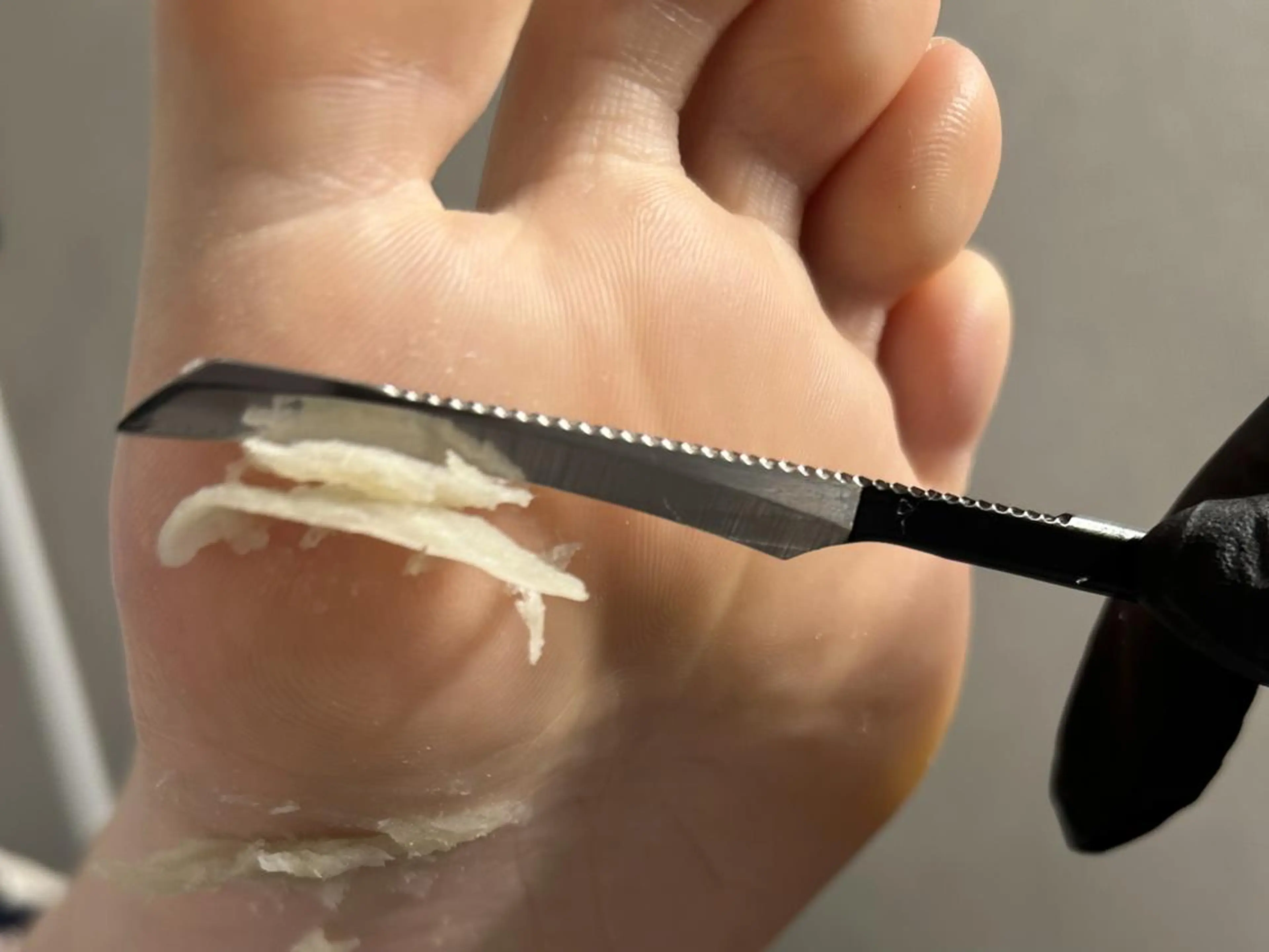 初回割引✨足裏つるつる✨韓国式足裏角質ケアスタンダードコース《ペディプランニング》の写真