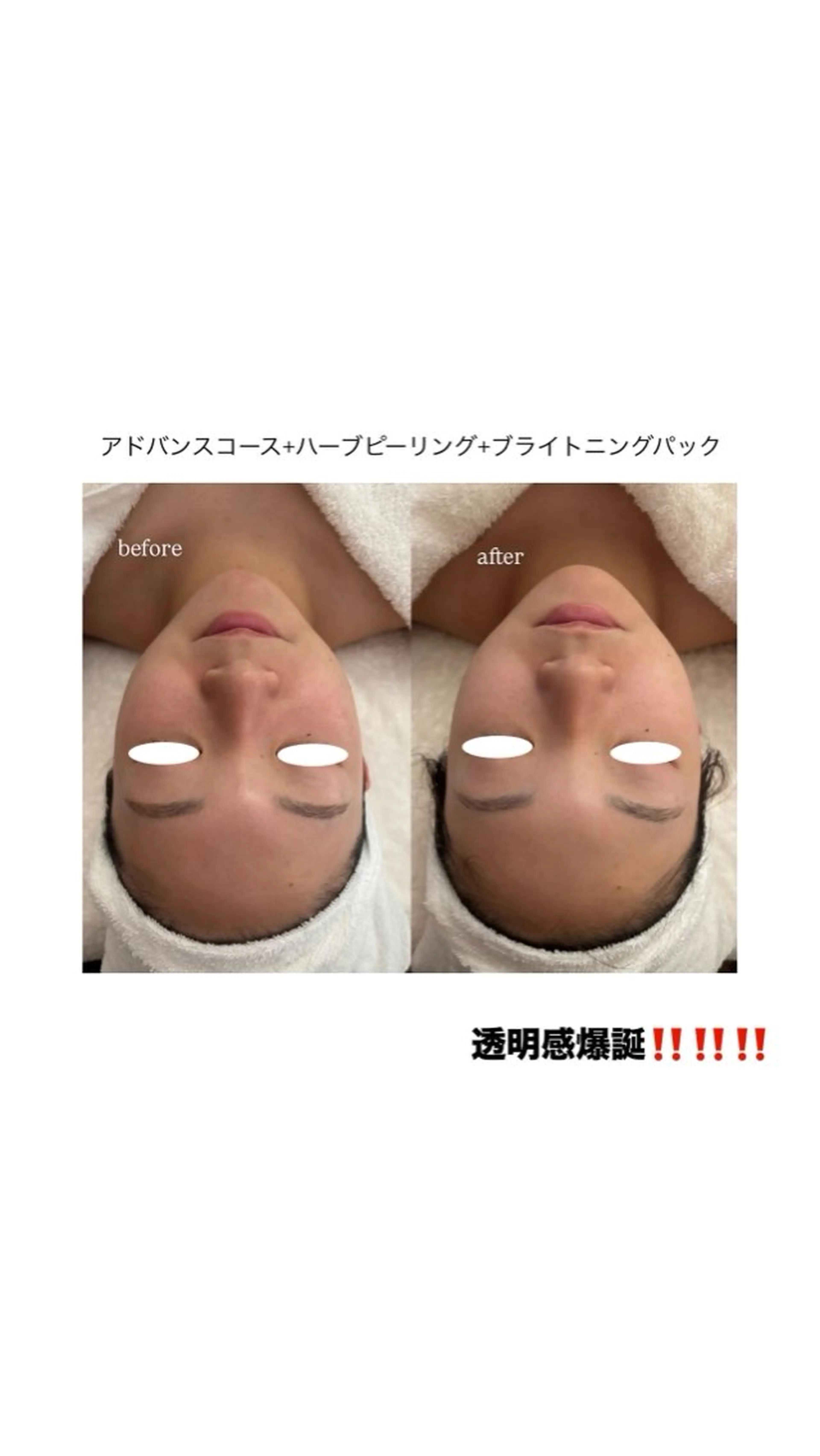 フェイシャルエステ 🎀　naoのエステ・リラクイメージ
