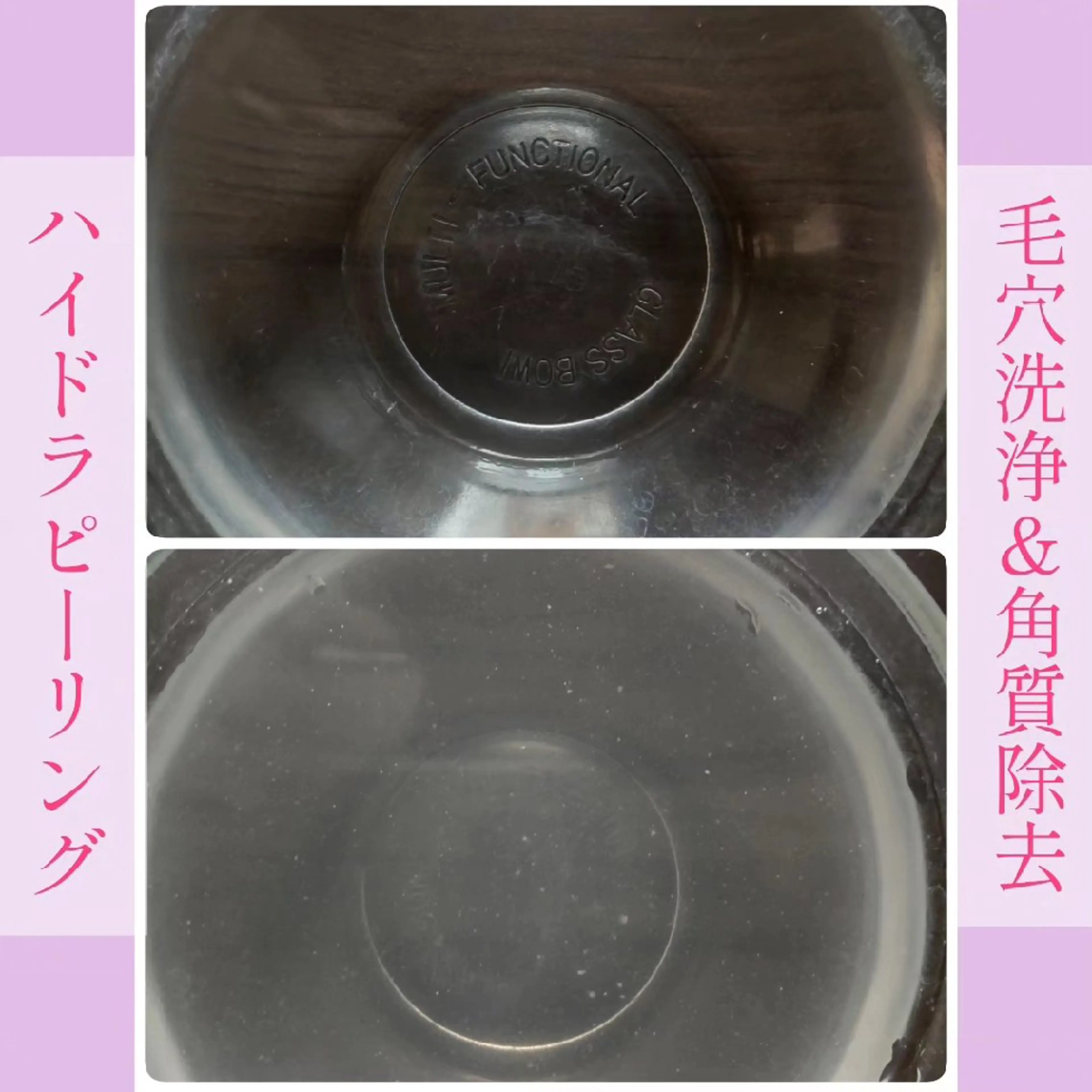 角質・毛穴洗浄🌼 脱毛🌸嶋津弘美のエステ・リラクイメージ