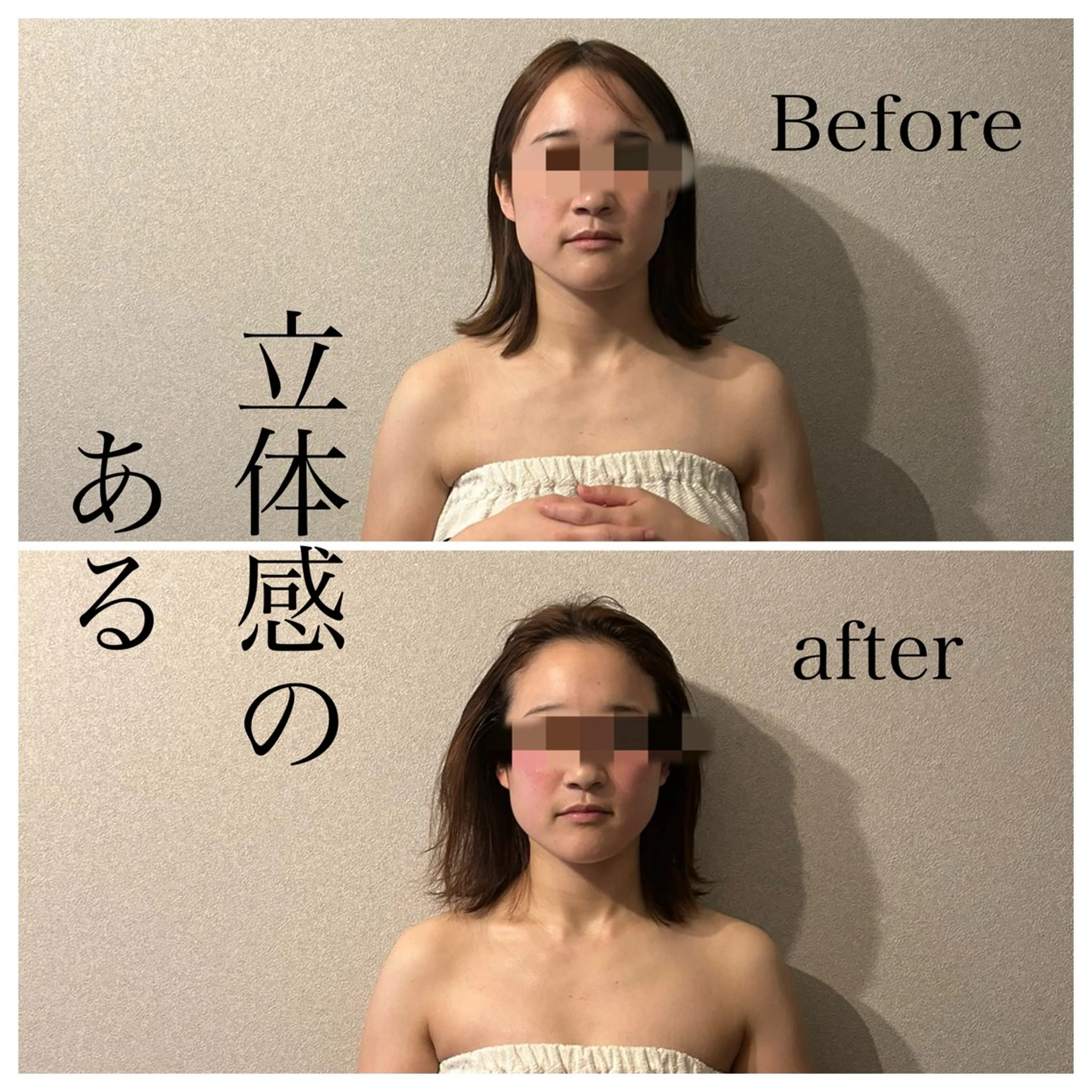 圧倒的たるみ改善 美容鍼エステのエステ・リラクイメージ