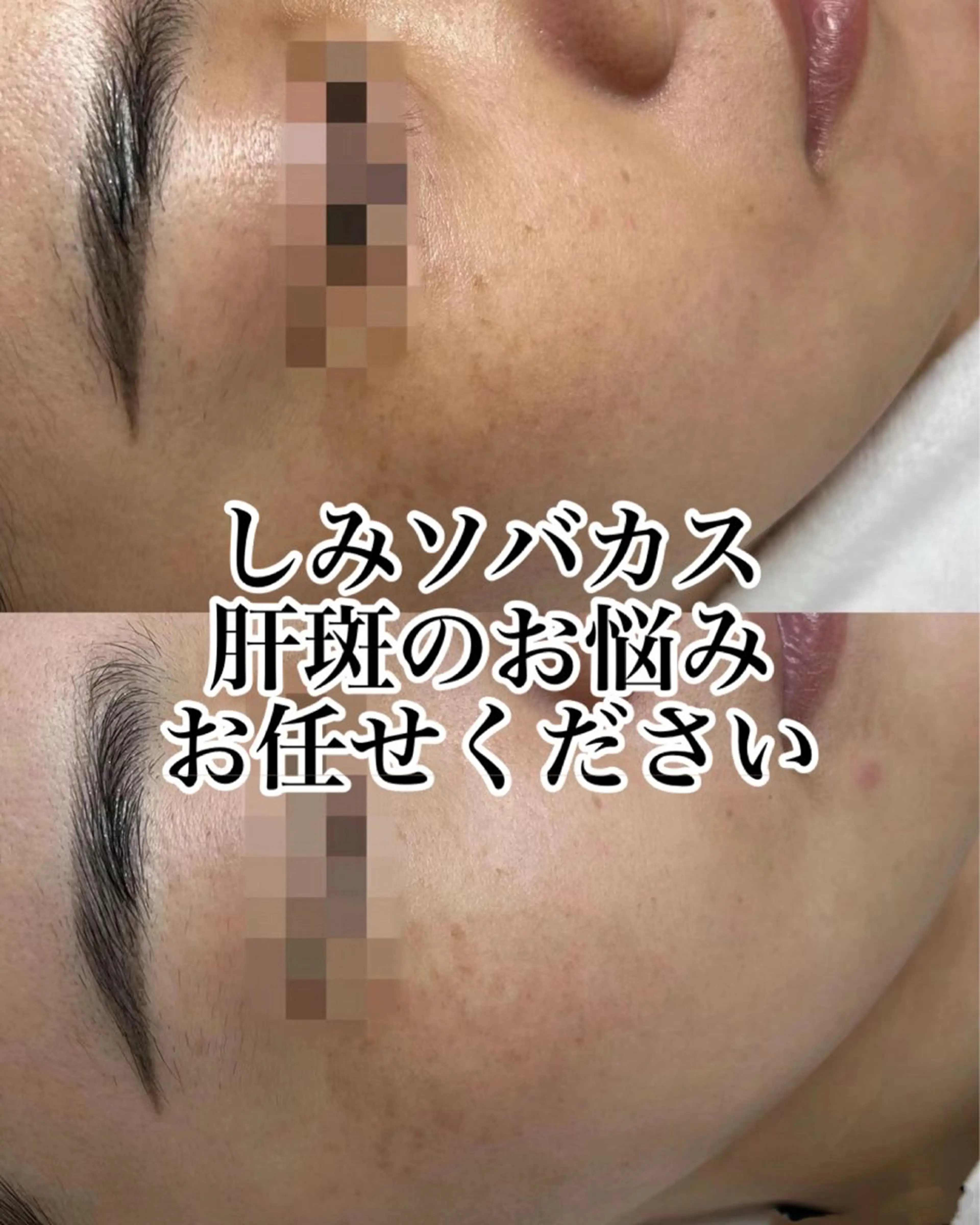 肌管理専門店 Shandeelのエステ・リラクイメージ