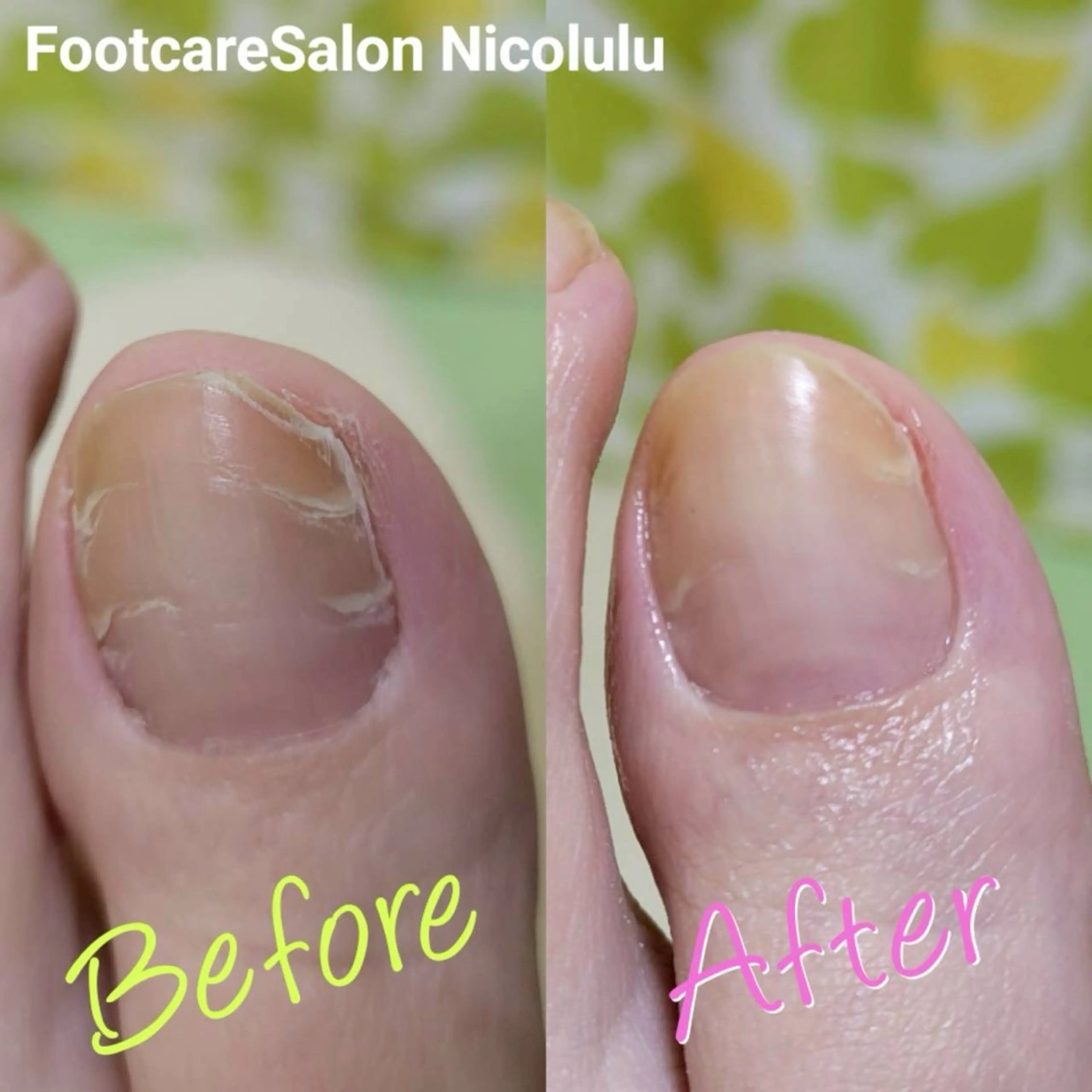 足トラブル専門 ニコルル金沢のエステ・リラクイメージ