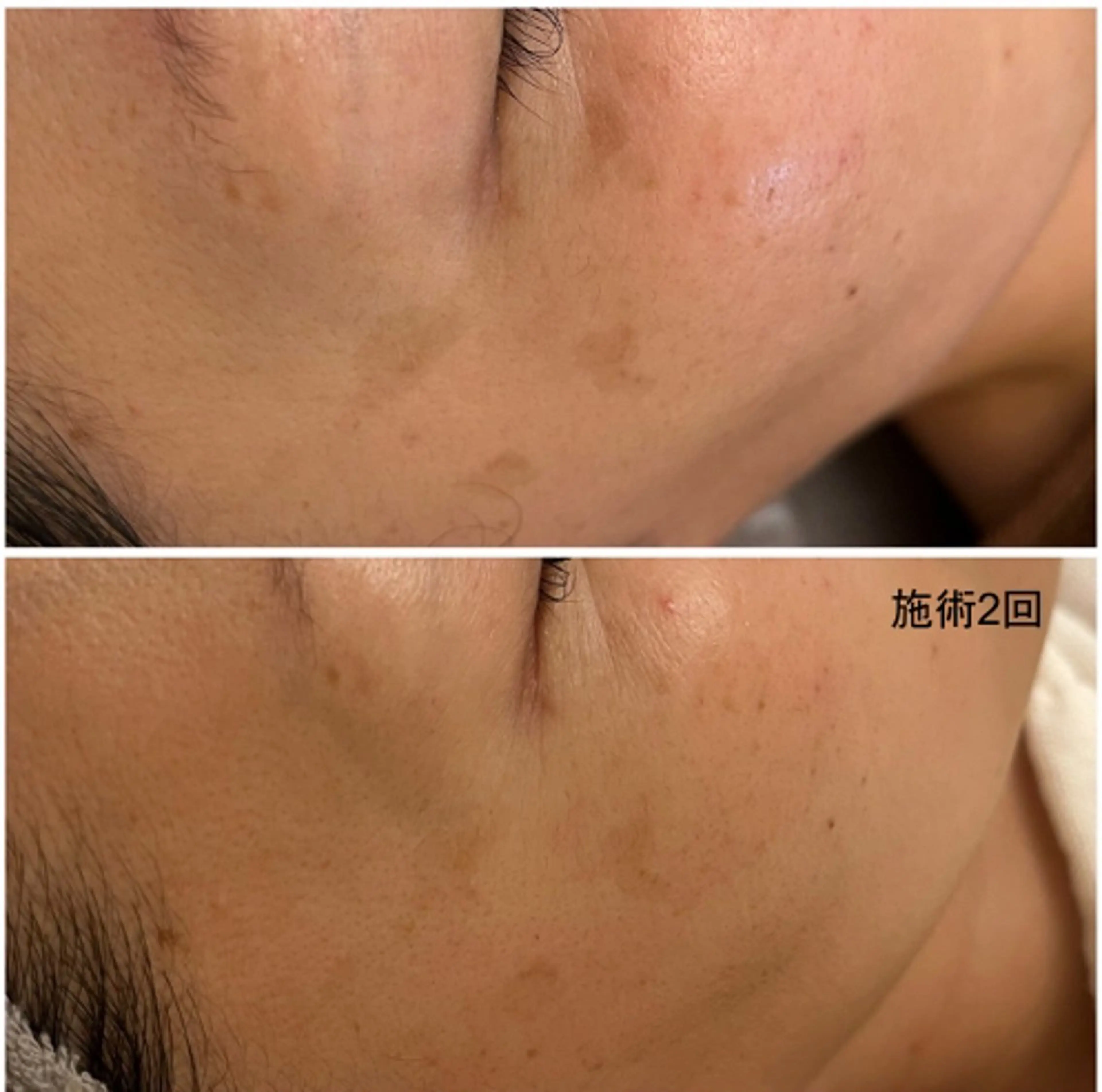 シミケア専門店 HAQUAのエステ・リラクイメージ