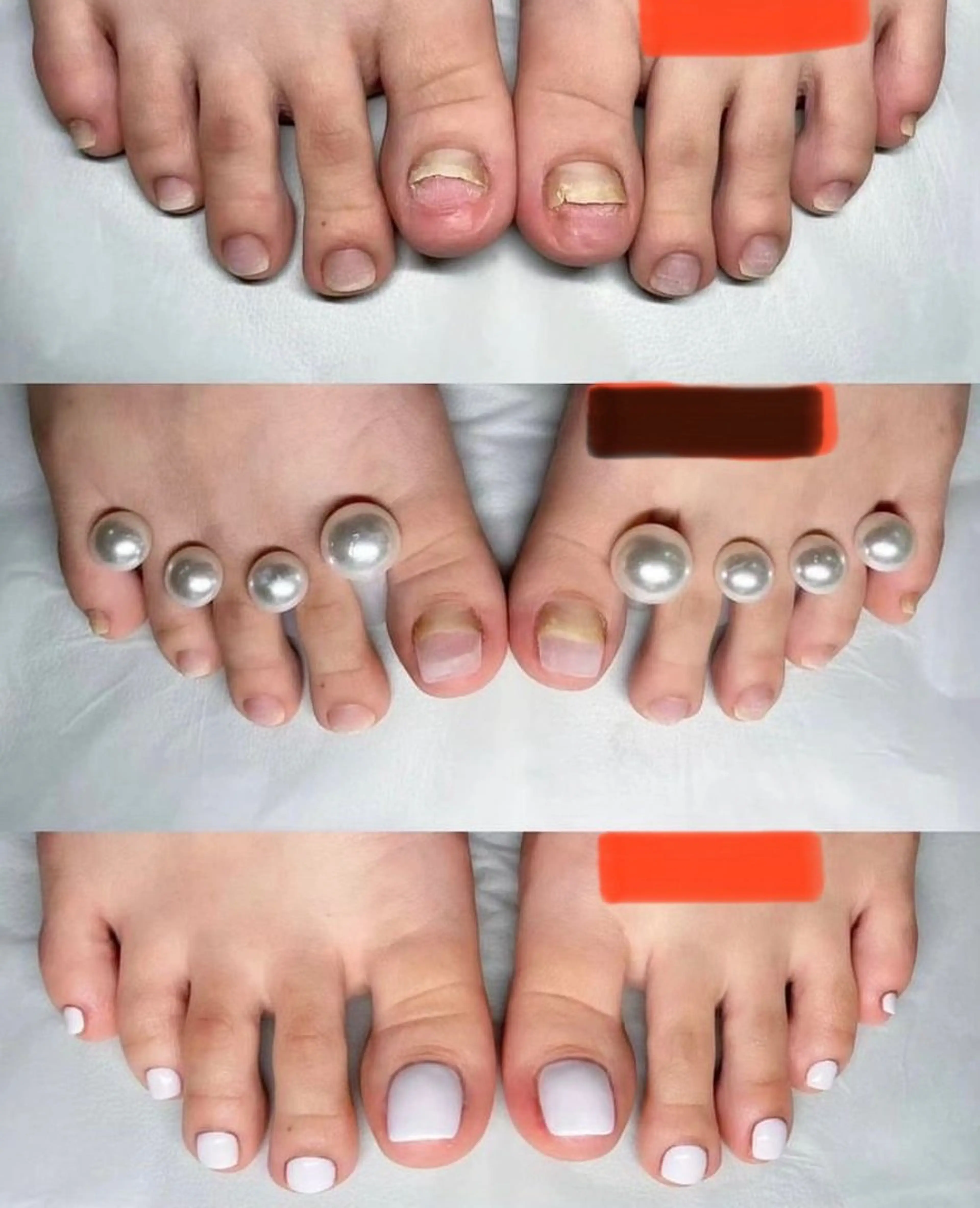 ネイル 長さ出し オトク ネイルのネイルデザイン