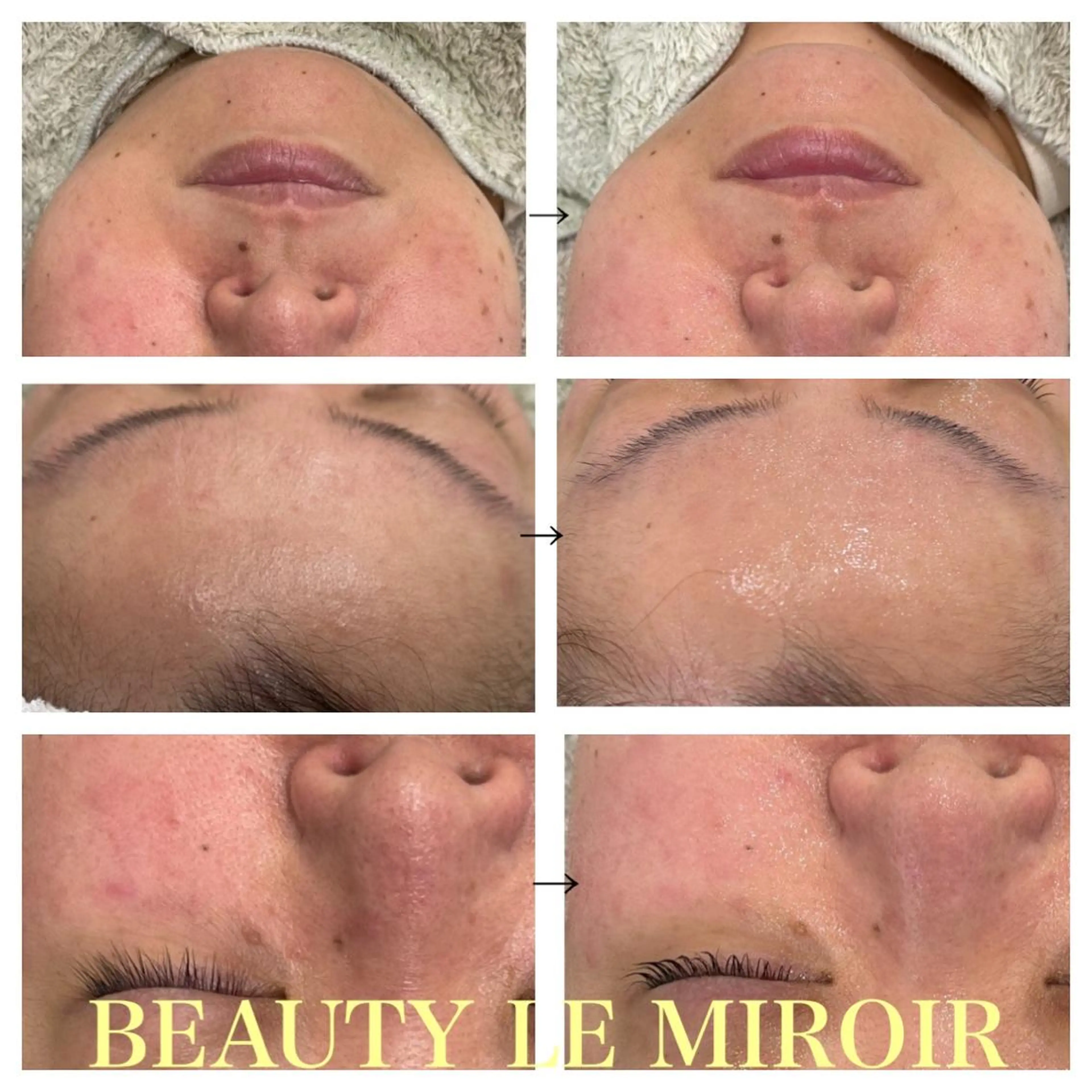 ビューティー ミロワールのエステ・リラクイメージ