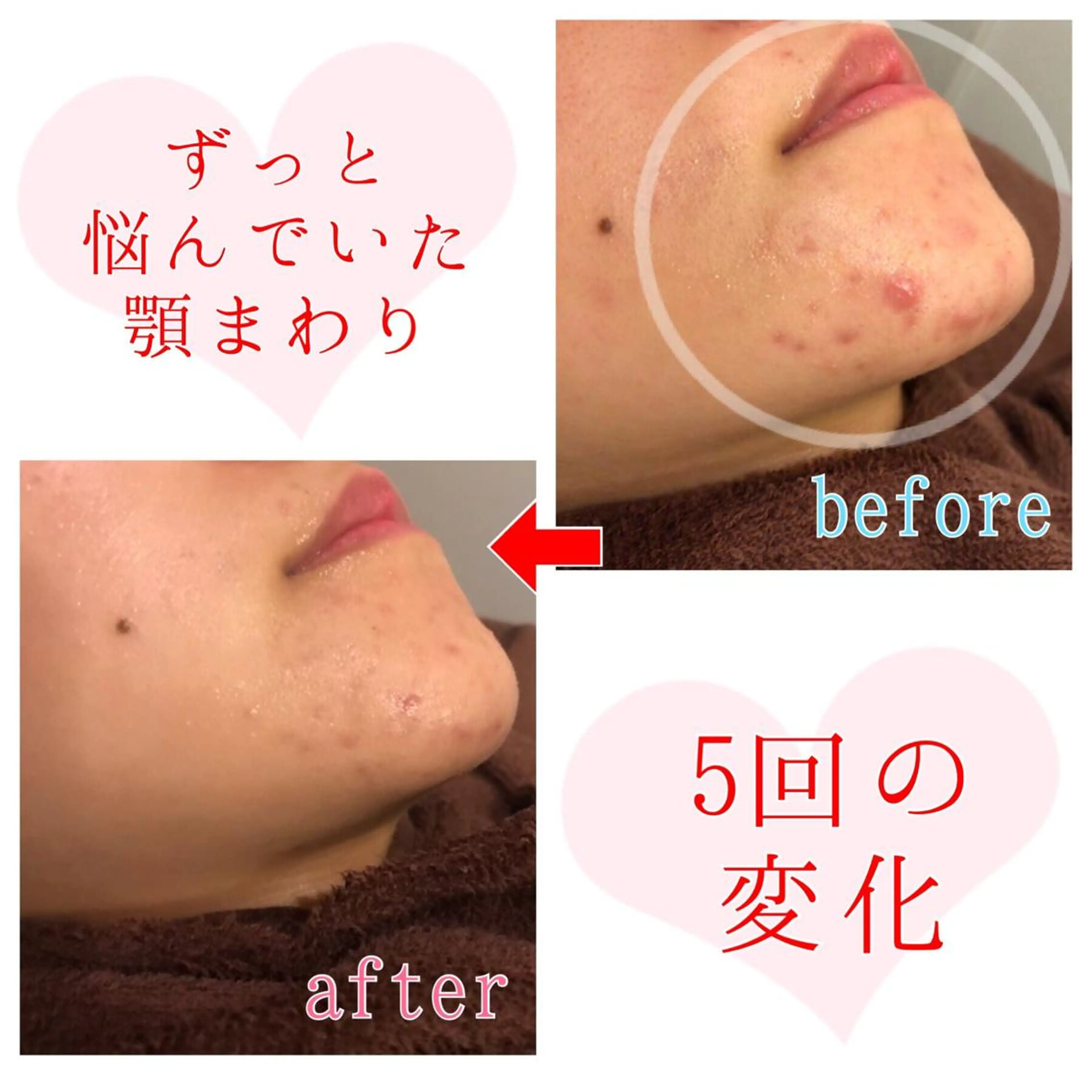 セミロング カラー パーマ ヘアアレンジ メンズ キッズ ネイル マツエク・マツパ 金の糸脱毛 産毛ケア専門のエステ・リラクイメージ