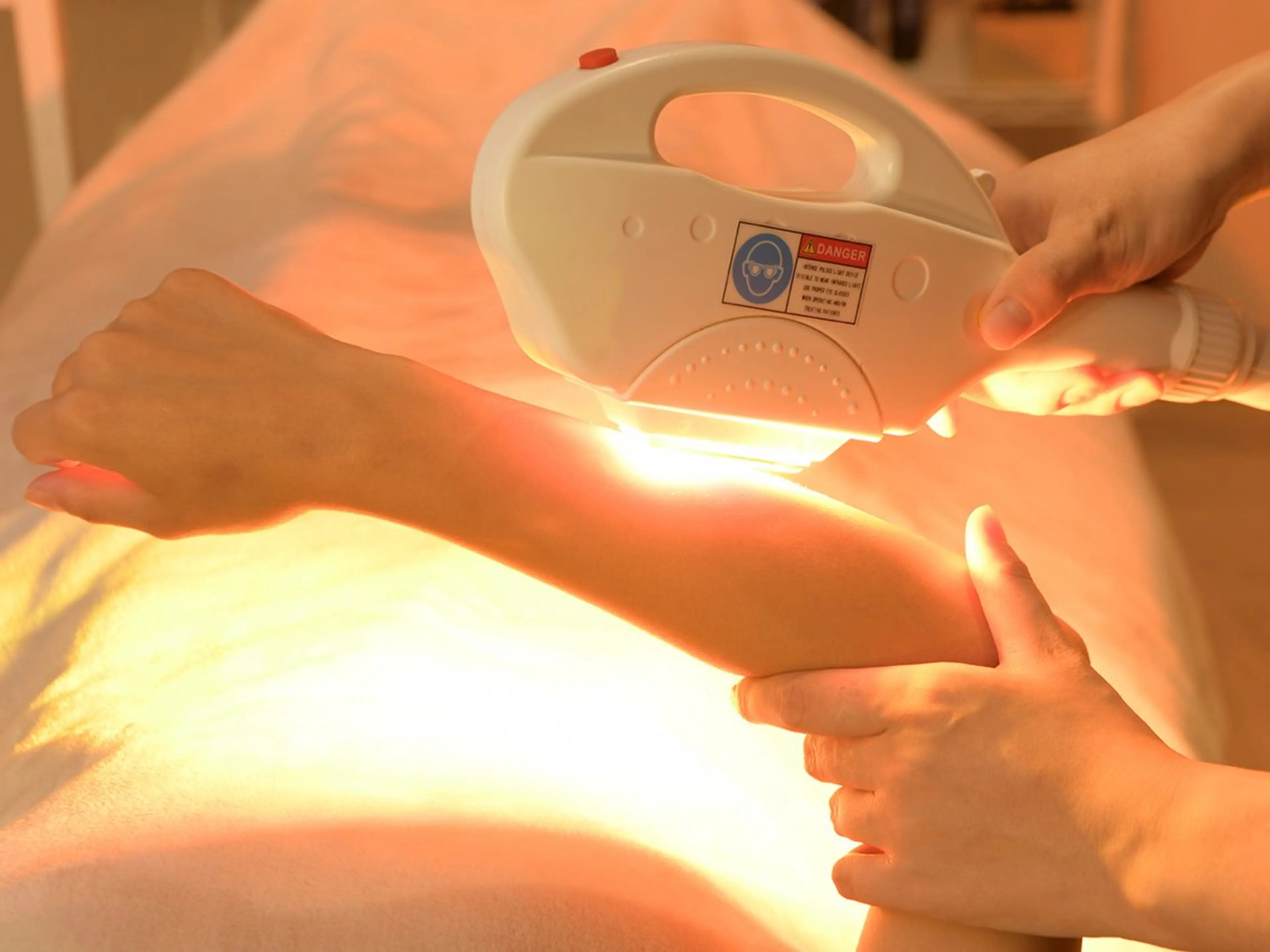 全身脱毛(顔込、VIO含まない)の写真