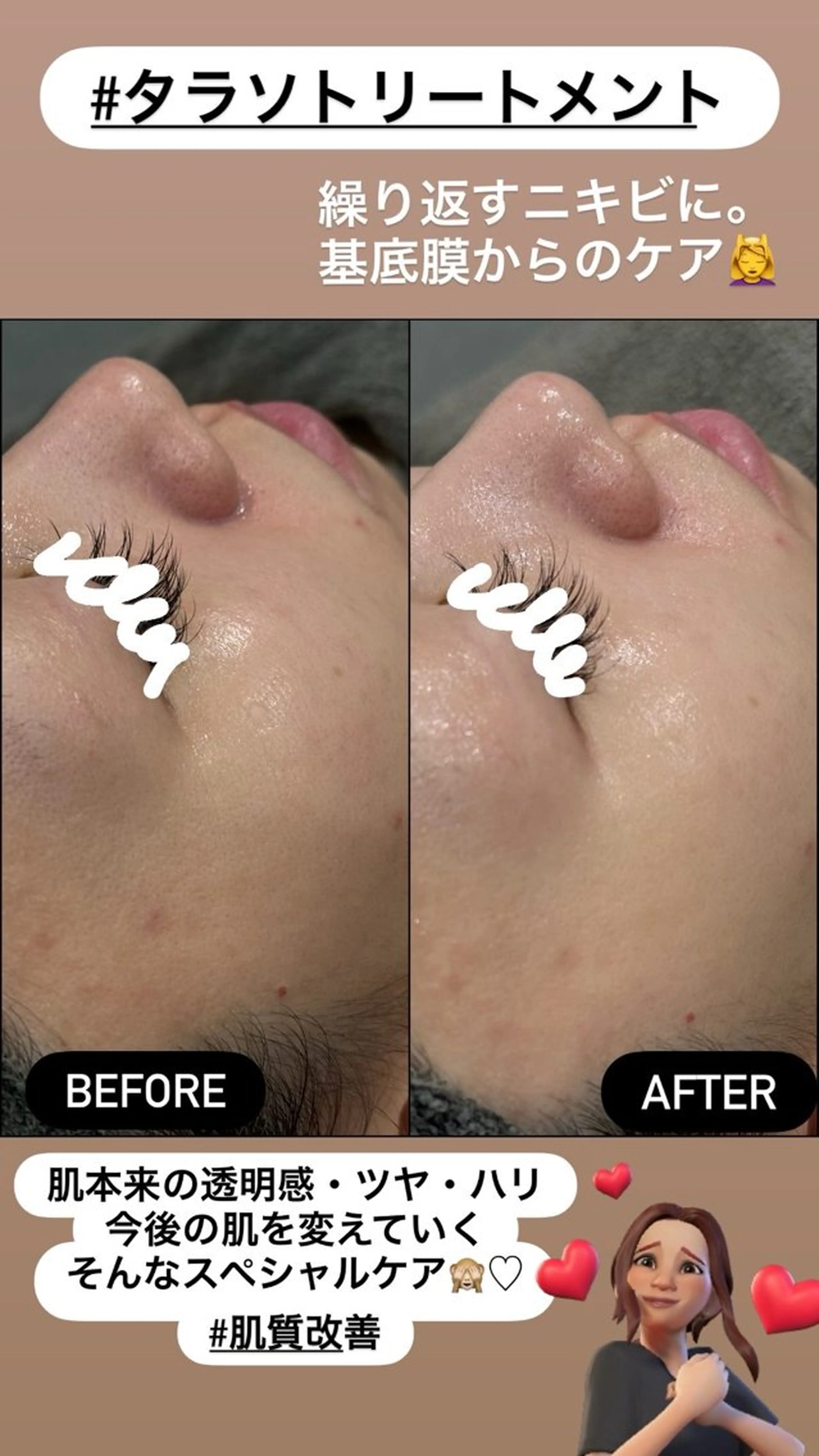 エステ LiZA エステティックサロンのエステ・リラクイメージ