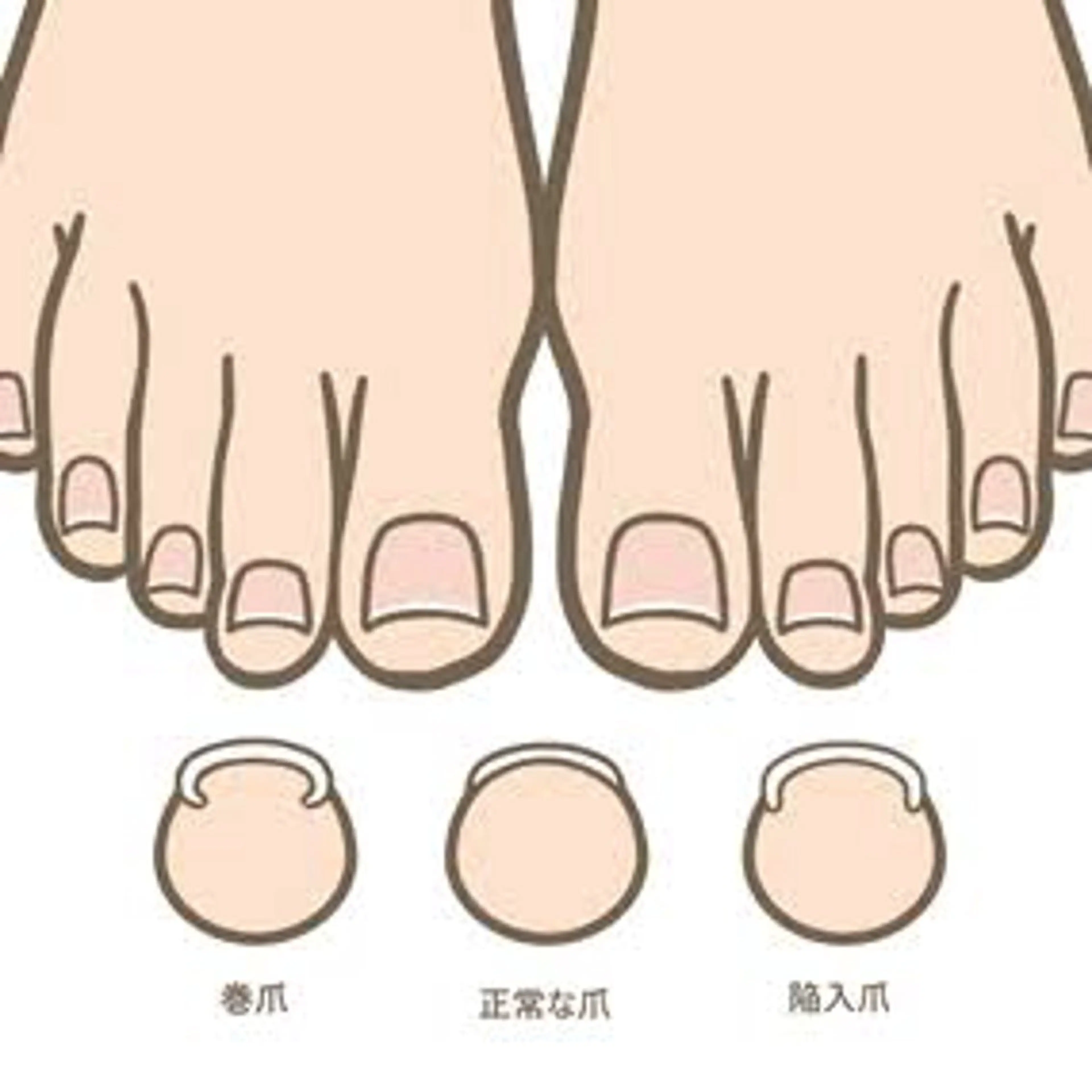 その他 巻き爪補正店 堺東店のネイルデザイン