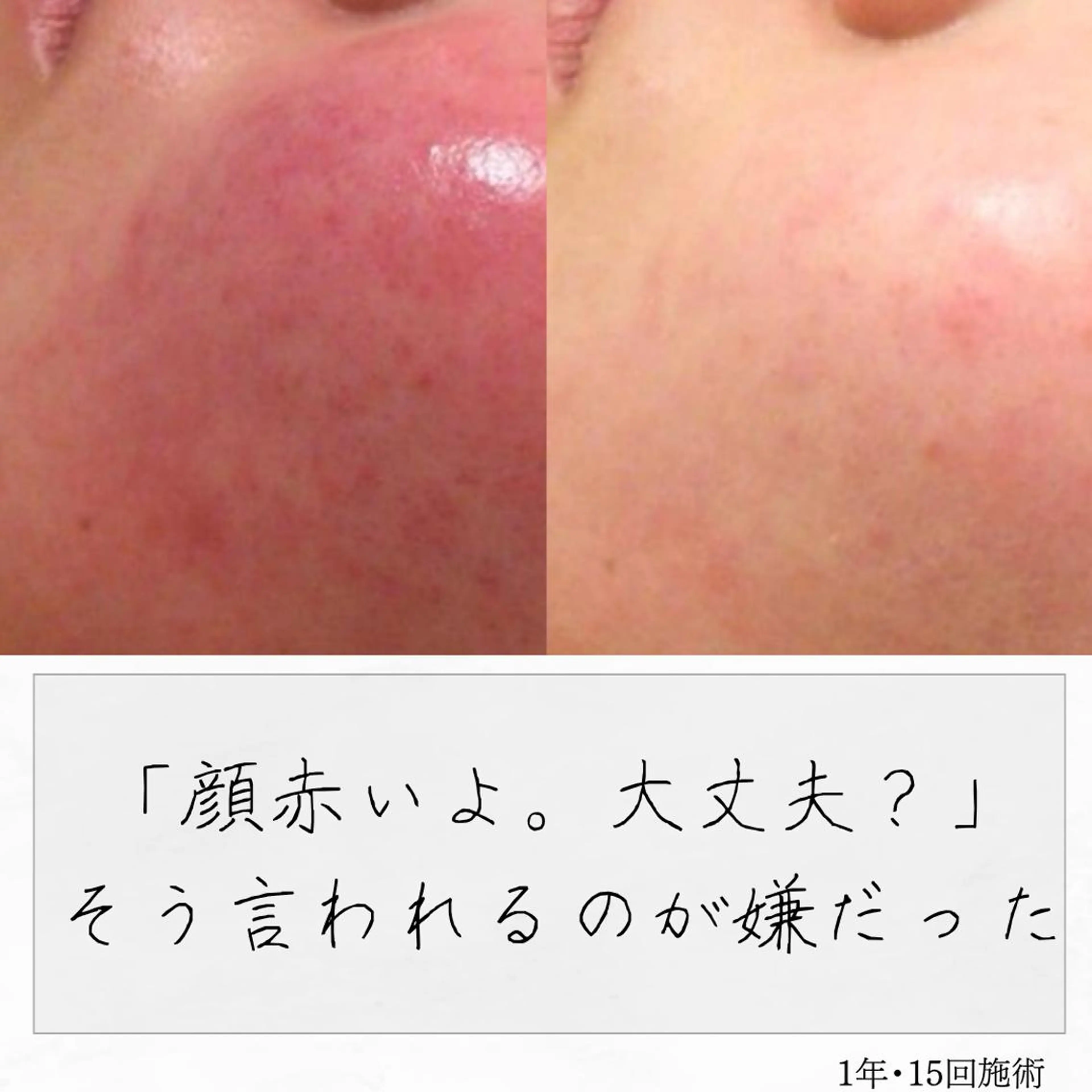 ニキビ経験者が施術 する専門サロン🌻のエステ・リラクイメージ