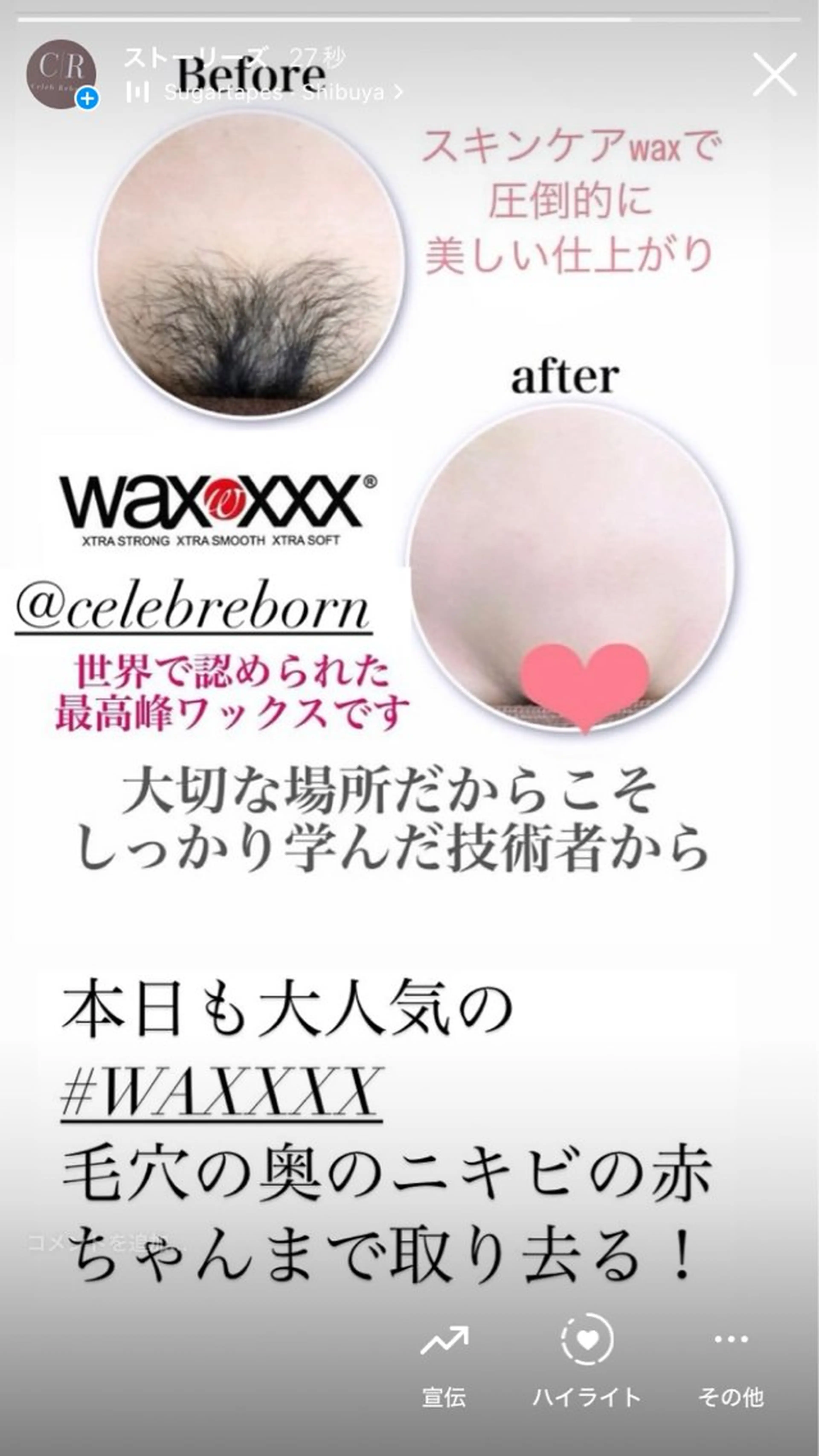 脱毛 目澤 幸代のその他イメージ