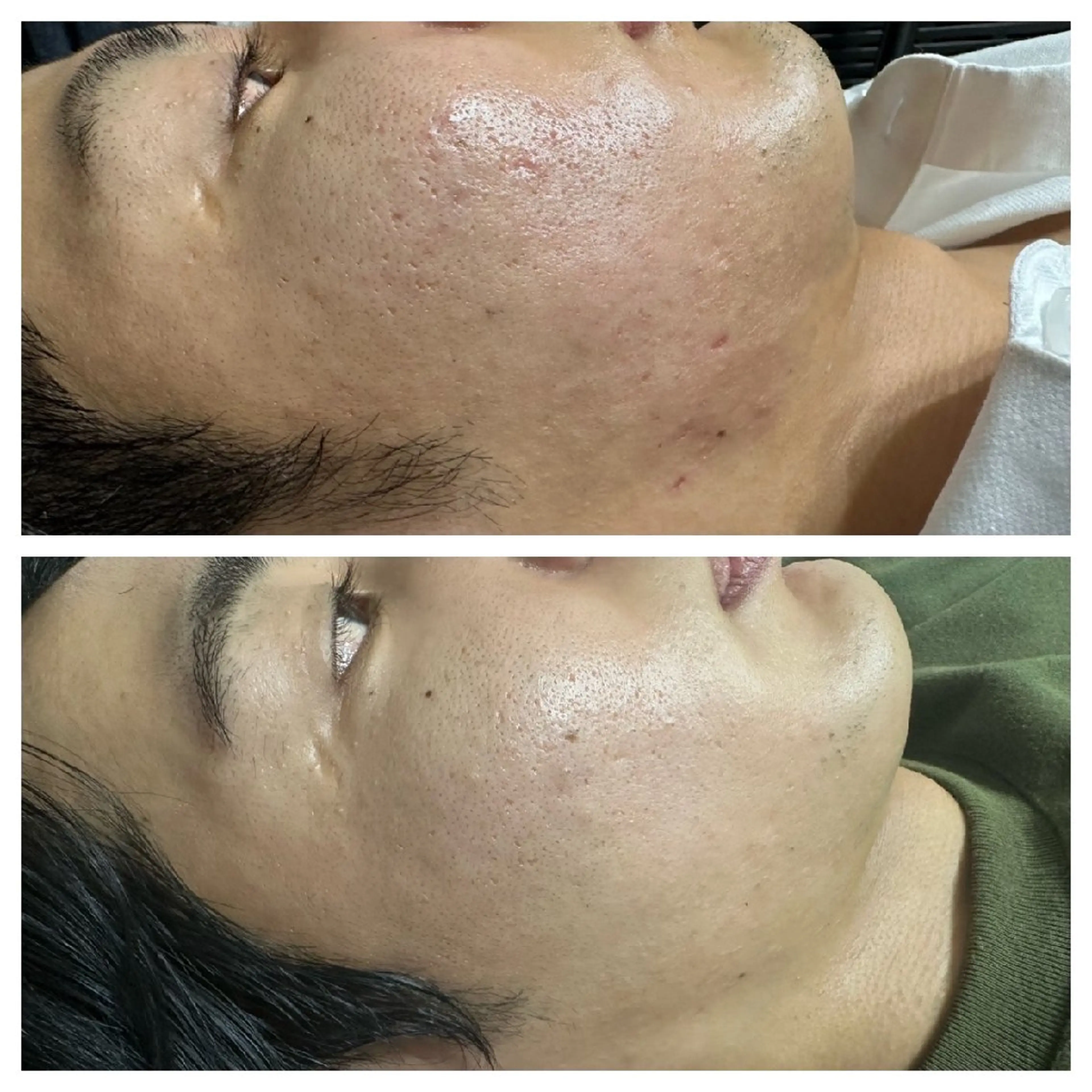 メンズ 肌質改善Beauty salon Renのエステ・リラクイメージ