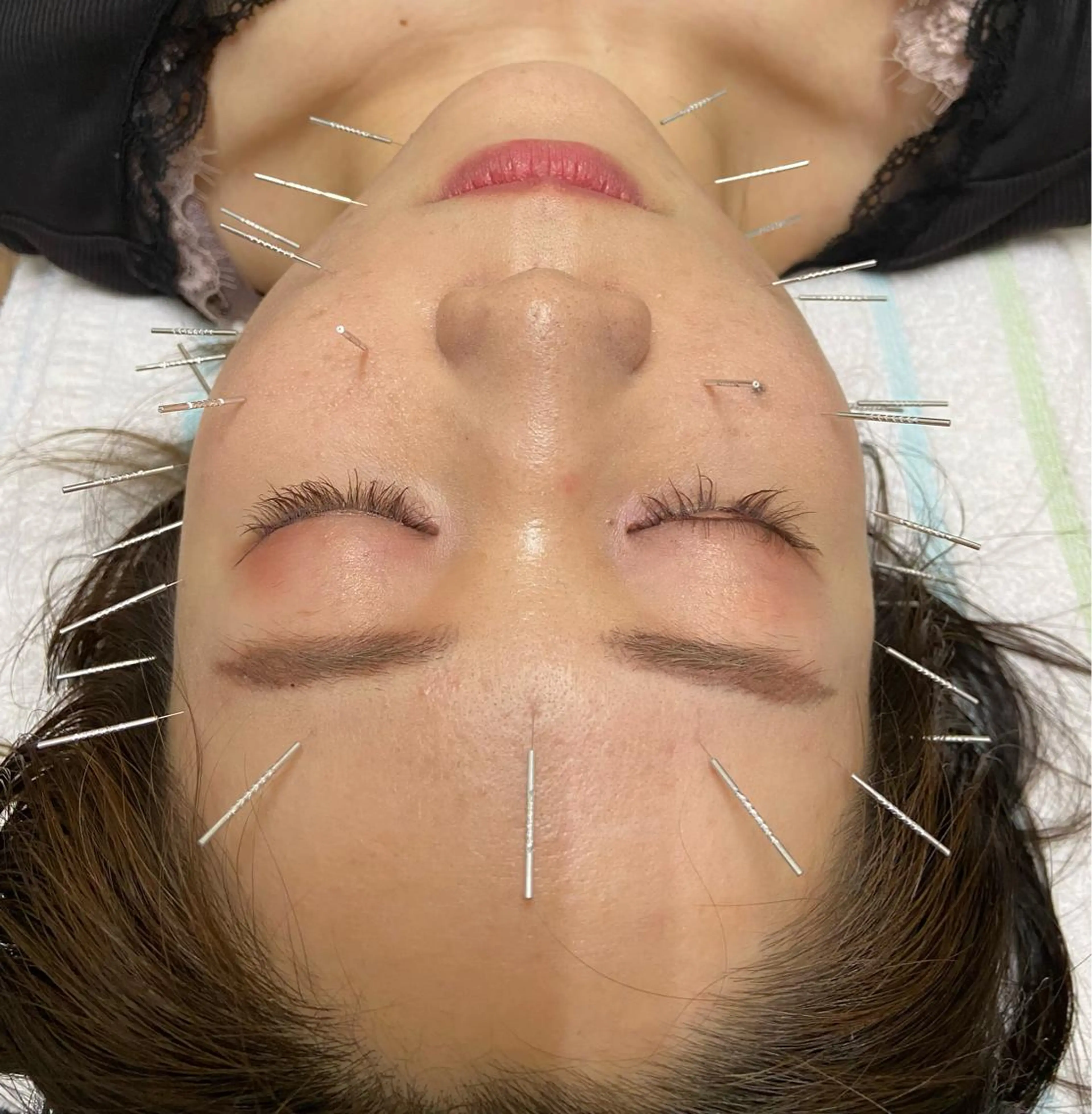 美容鍼灸サロン REPOSのその他イメージ