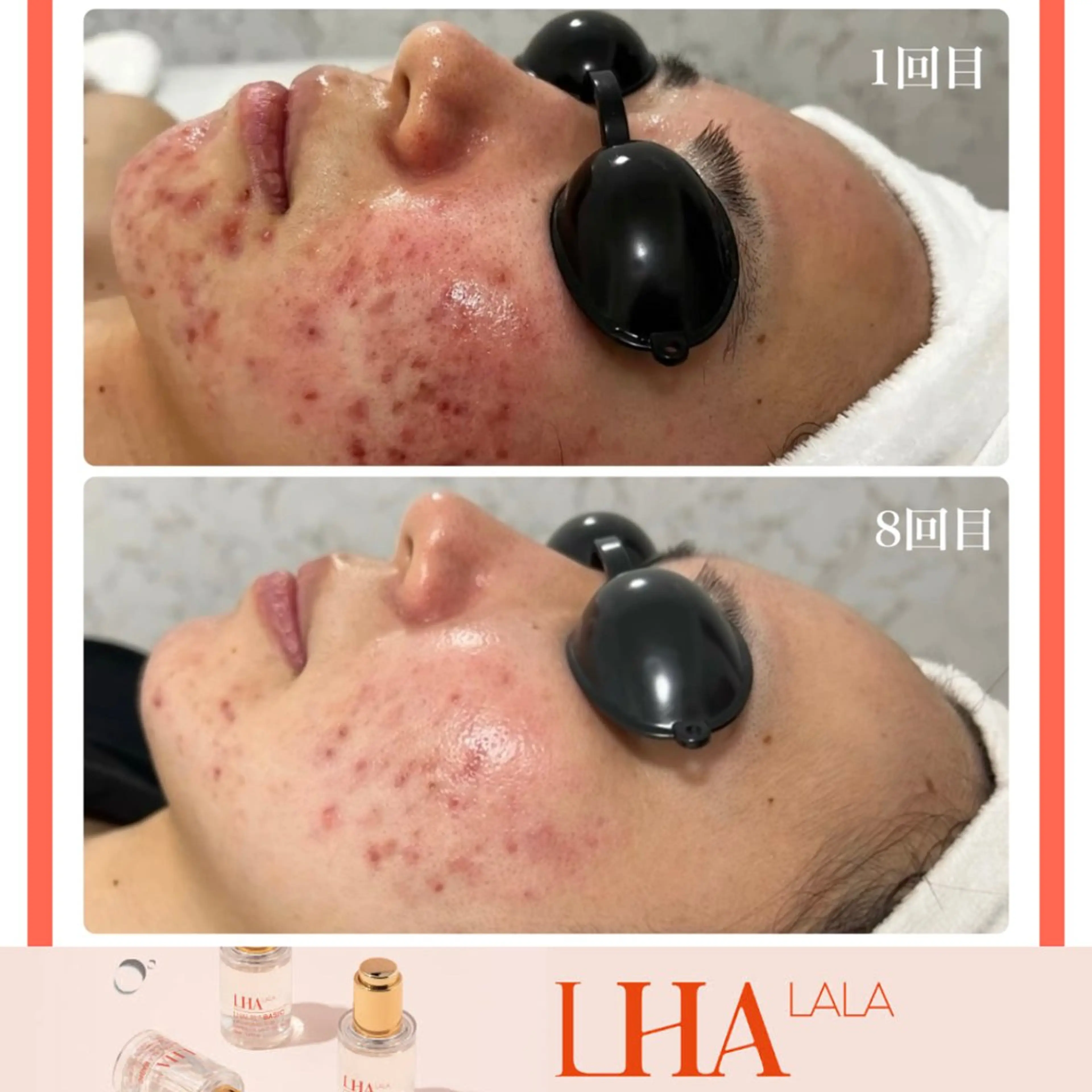 LiAm《美肌管理/ 小顔/脂肪ケア》のその他イメージ