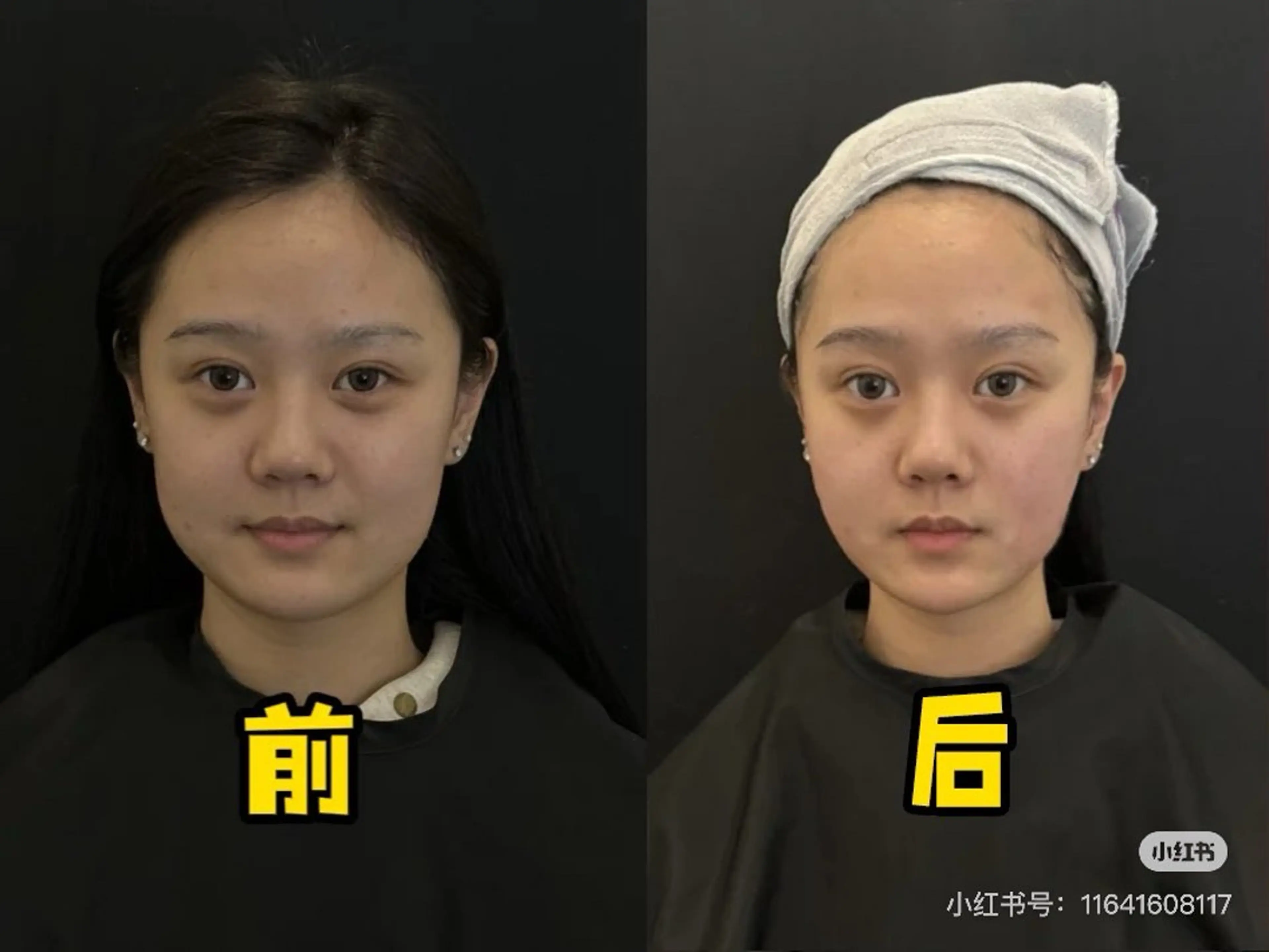 ネイル 韓国ネイル エステ aliaハーブ水光店 エステティシャン募集のエステ・リラクイメージ