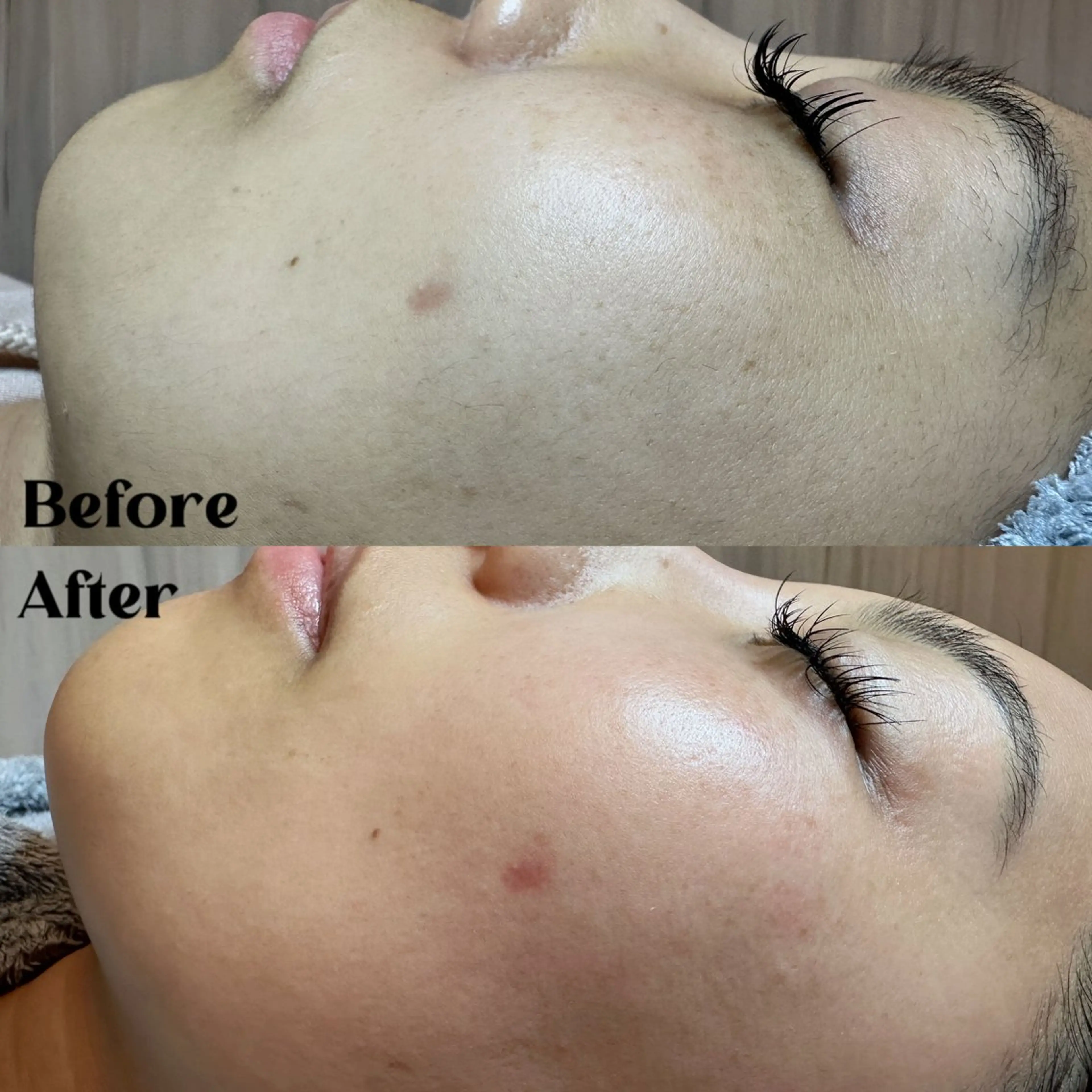 Hitomi シュガーリング豊橋のその他イメージ