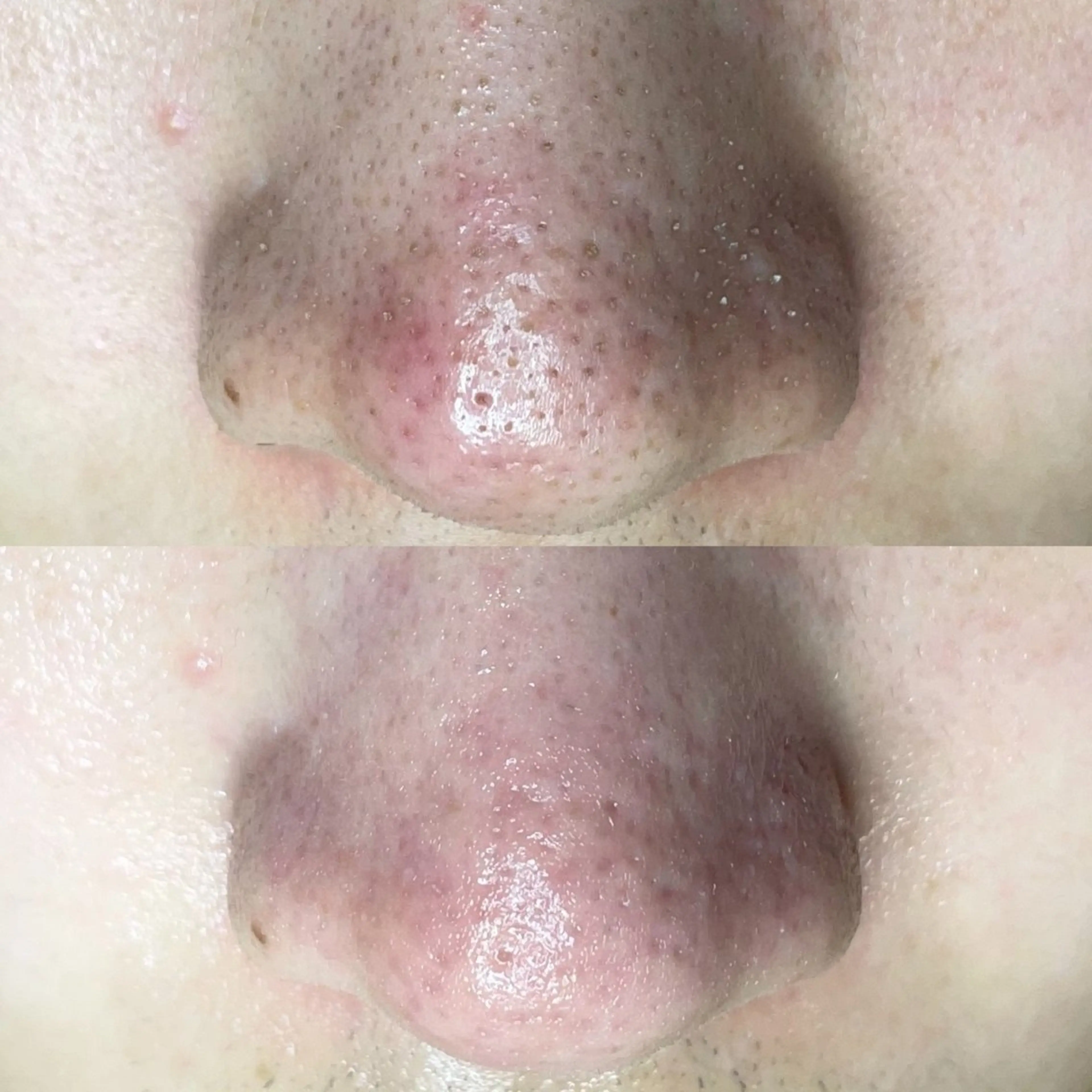 毛穴・頭皮 専門店💪のその他イメージ