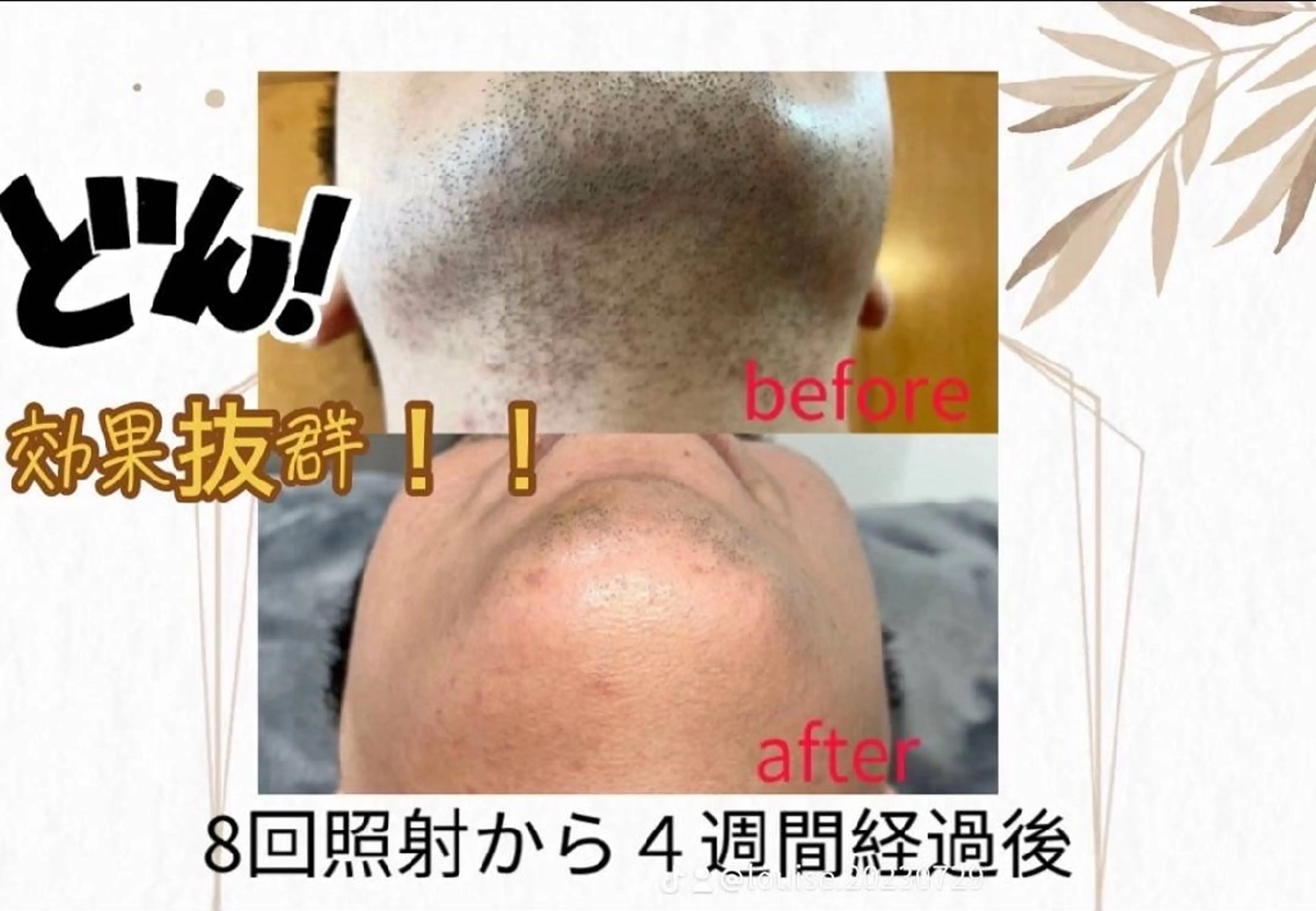 LOUISE. ／脱毛のエステ・リラクイメージ