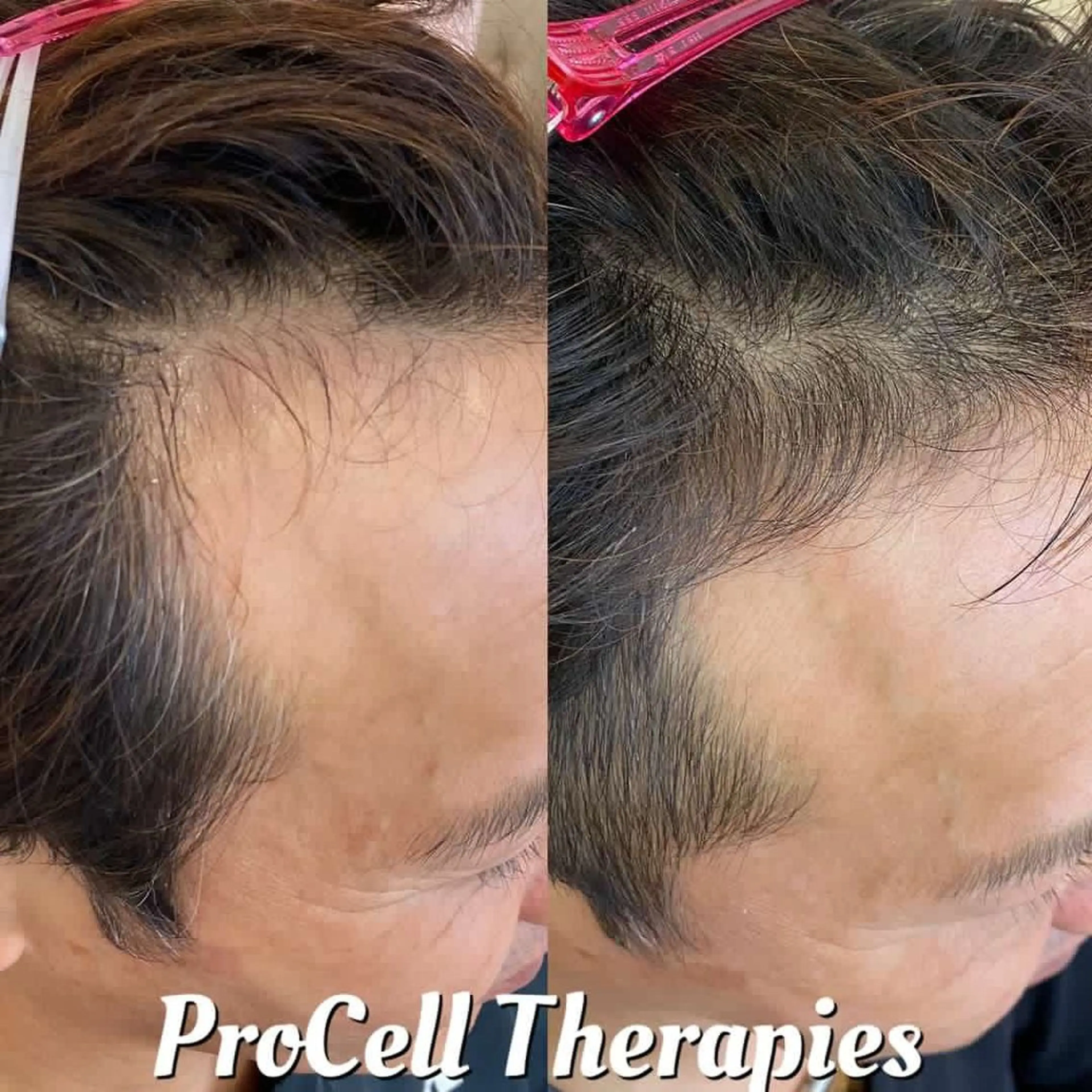 LOUISE. ／肌質・頭皮のエステ・リラクイメージ