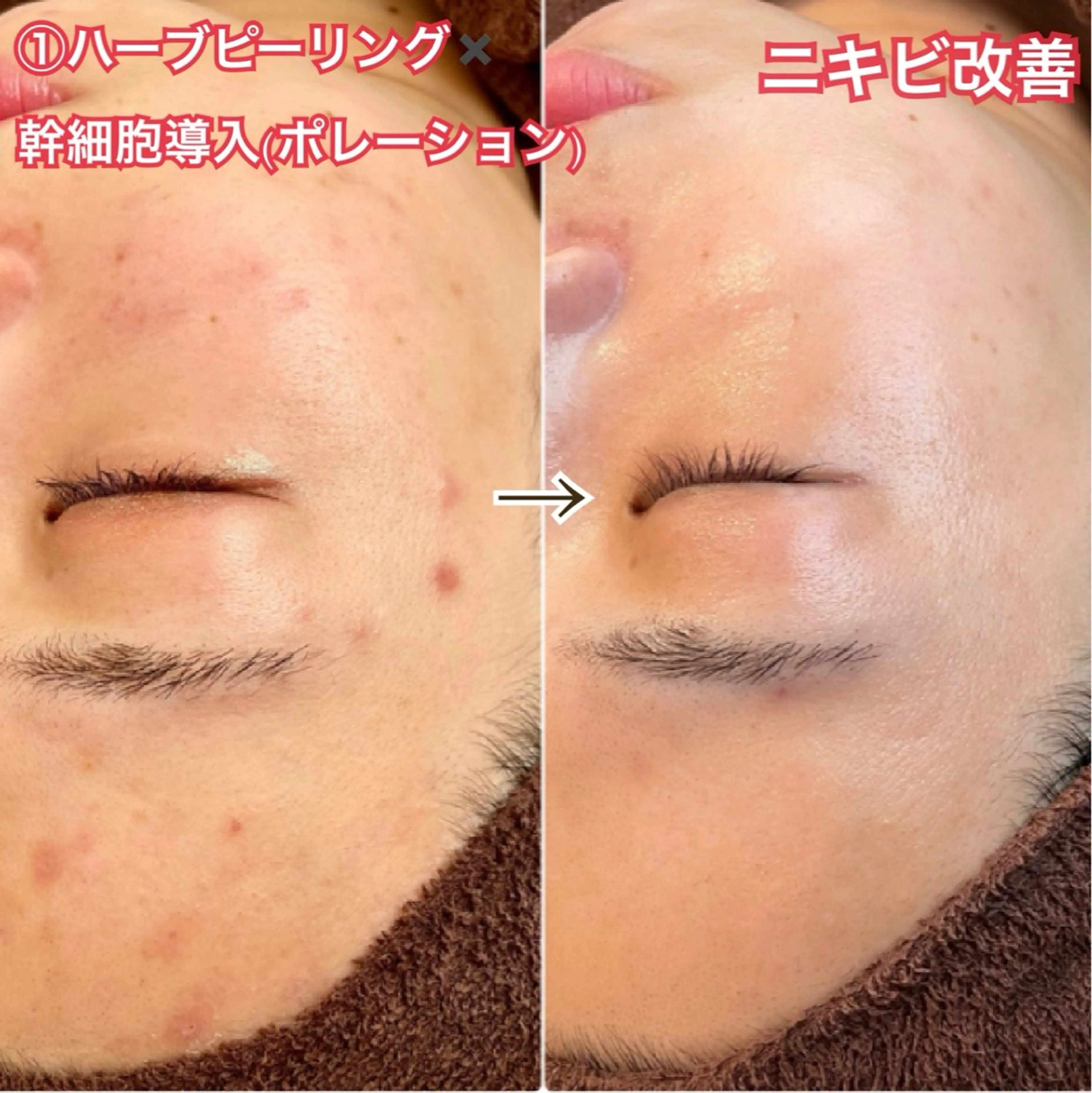 エステ LAESSE 恵比寿所属・毛穴と美白の専門店 LAESSE 恵比寿のエステ・リラクイメージ