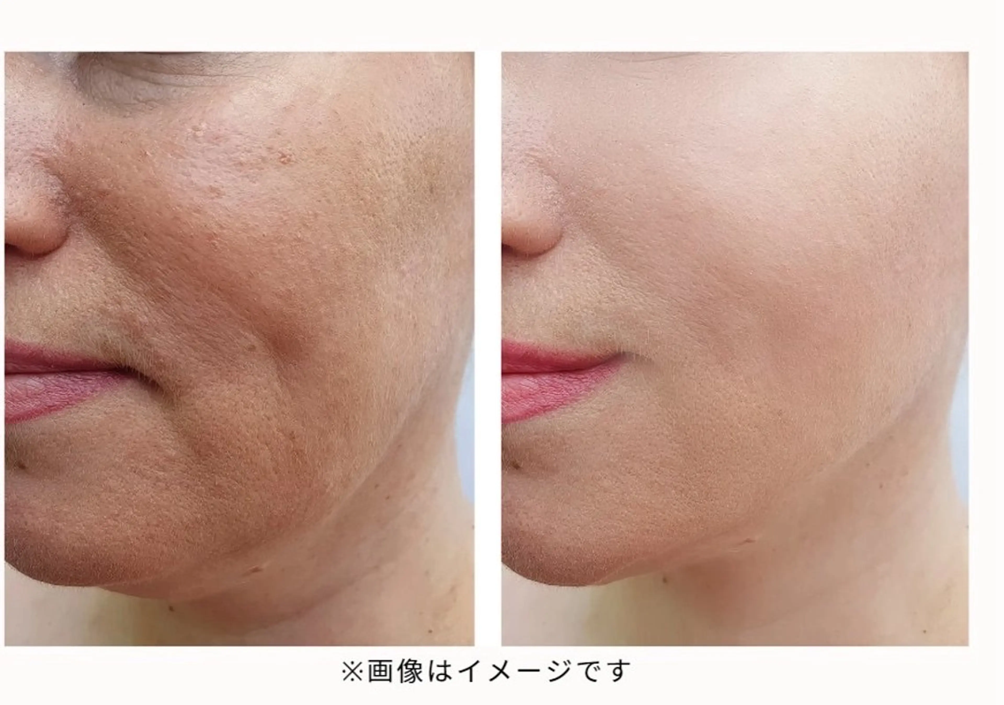 エステ TAKEMOTO TOMIKOのエステ・リラクイメージ