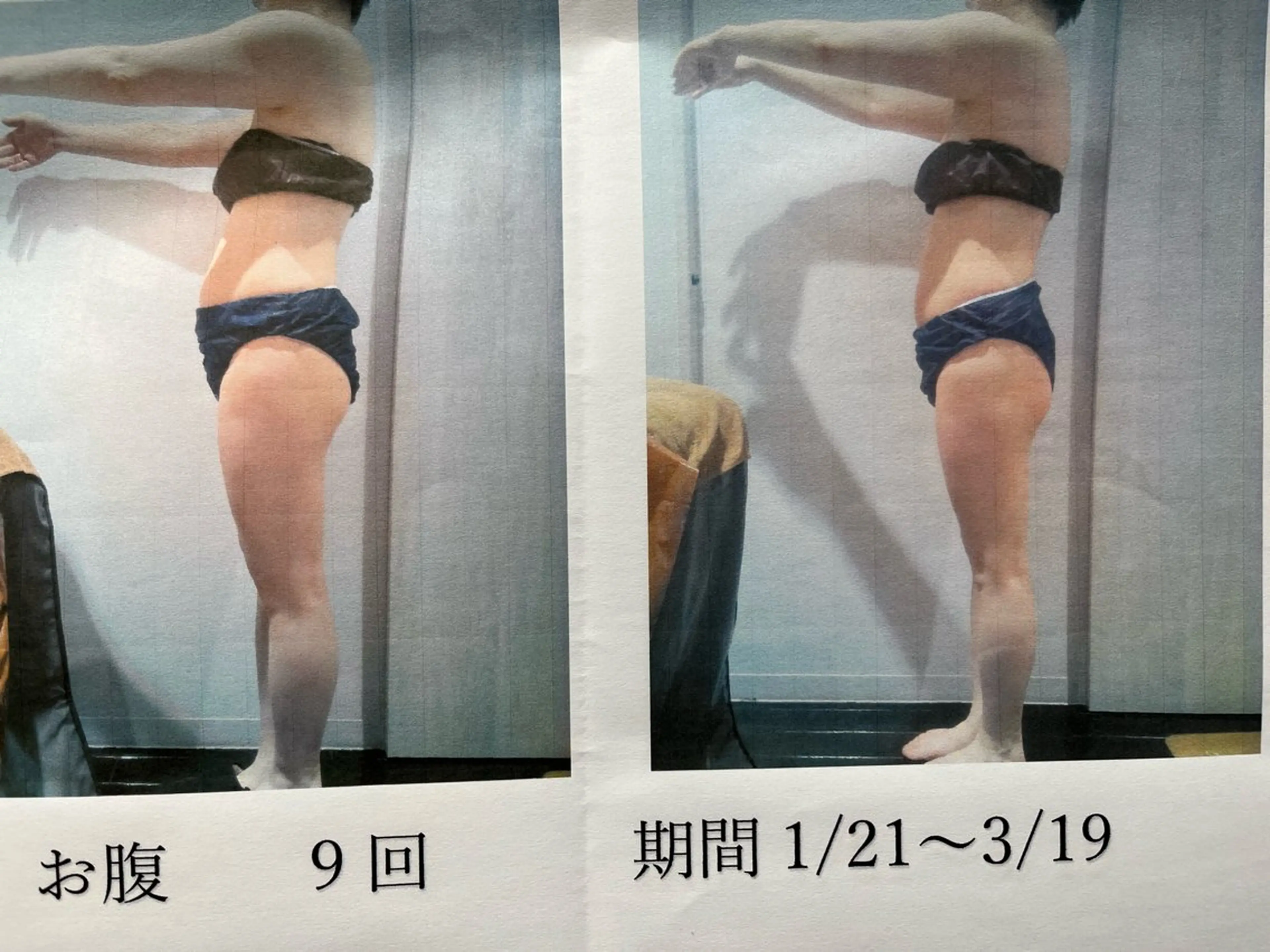 脱毛フェイシャル痩身 エリア最安👑永野舞のエステ・リラクイメージ