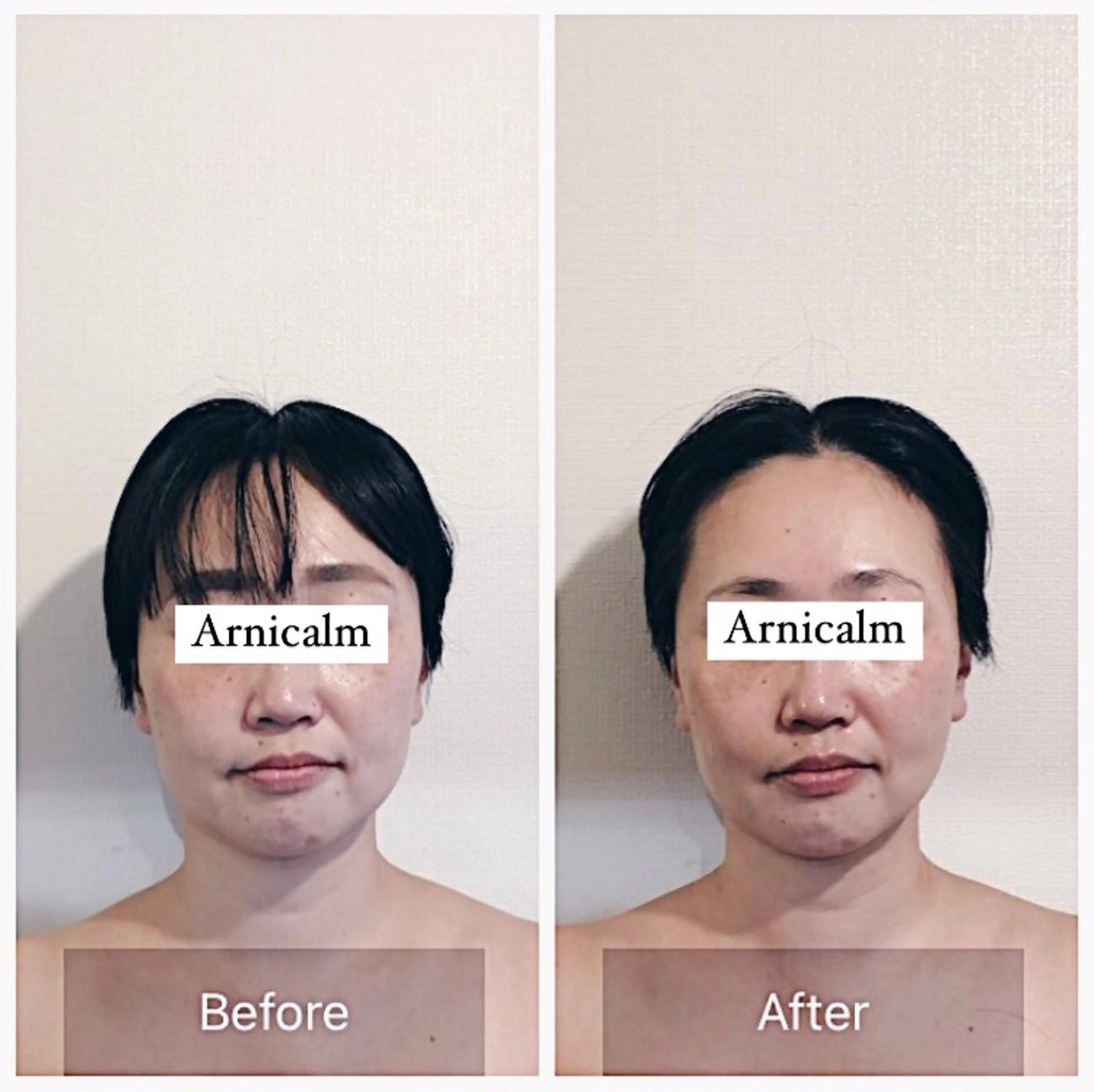 ハーブピーリング 肌再生ピーリング/のエステ・リラクイメージ