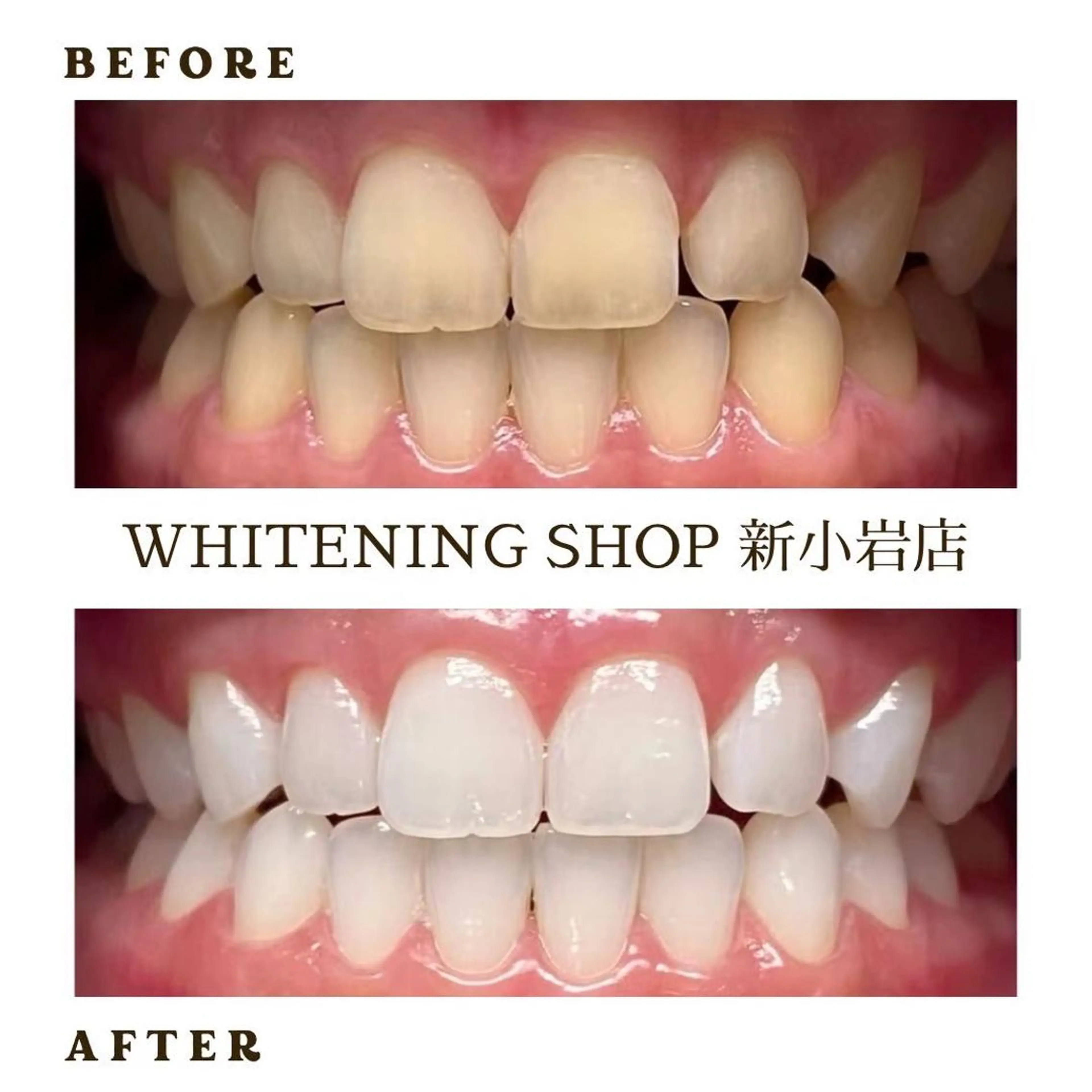 メンズ その他 ホワイトニング ショップ新小岩店のその他イメージ