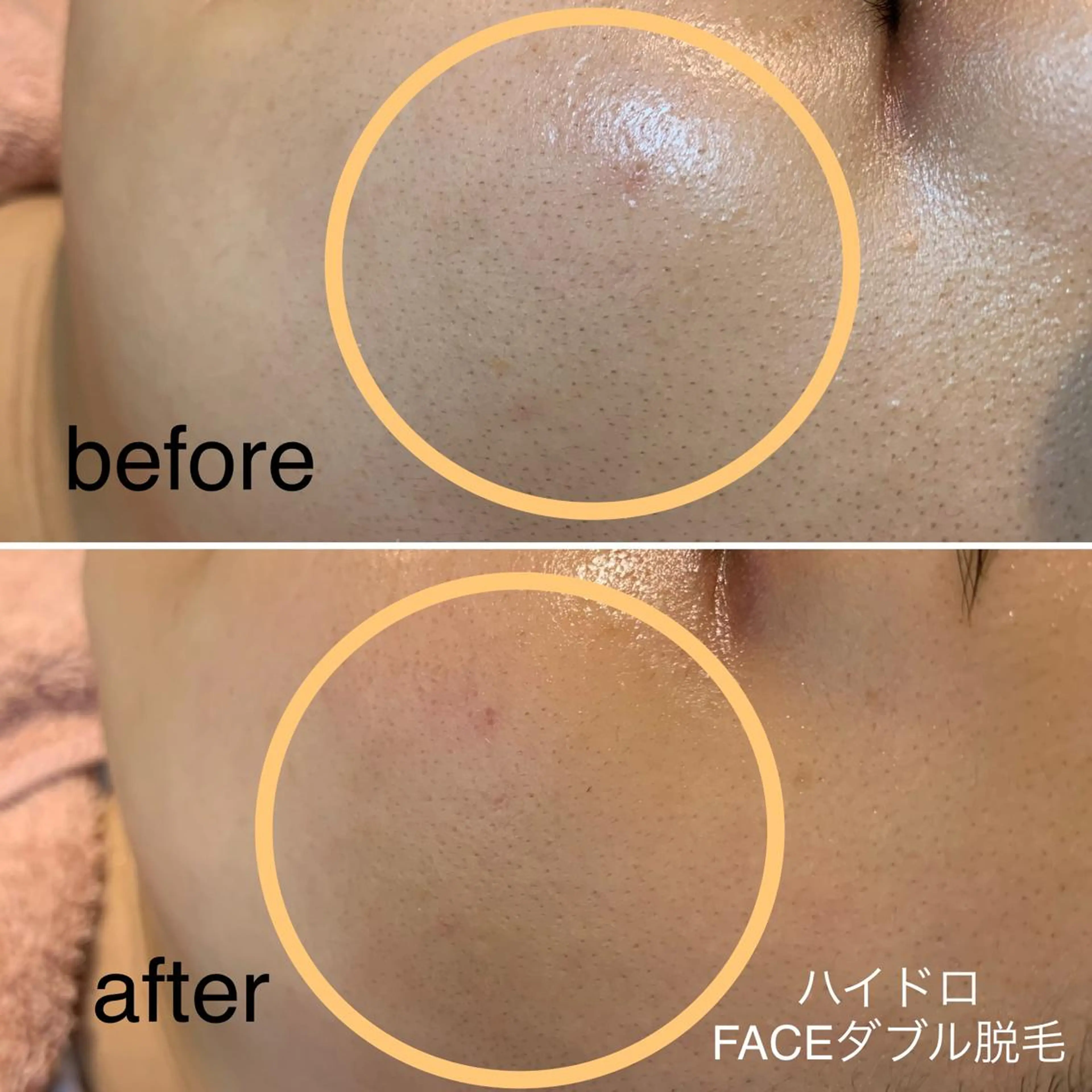 脱毛＆エステサロン JIGGLY☆松田のエステ・リラクイメージ